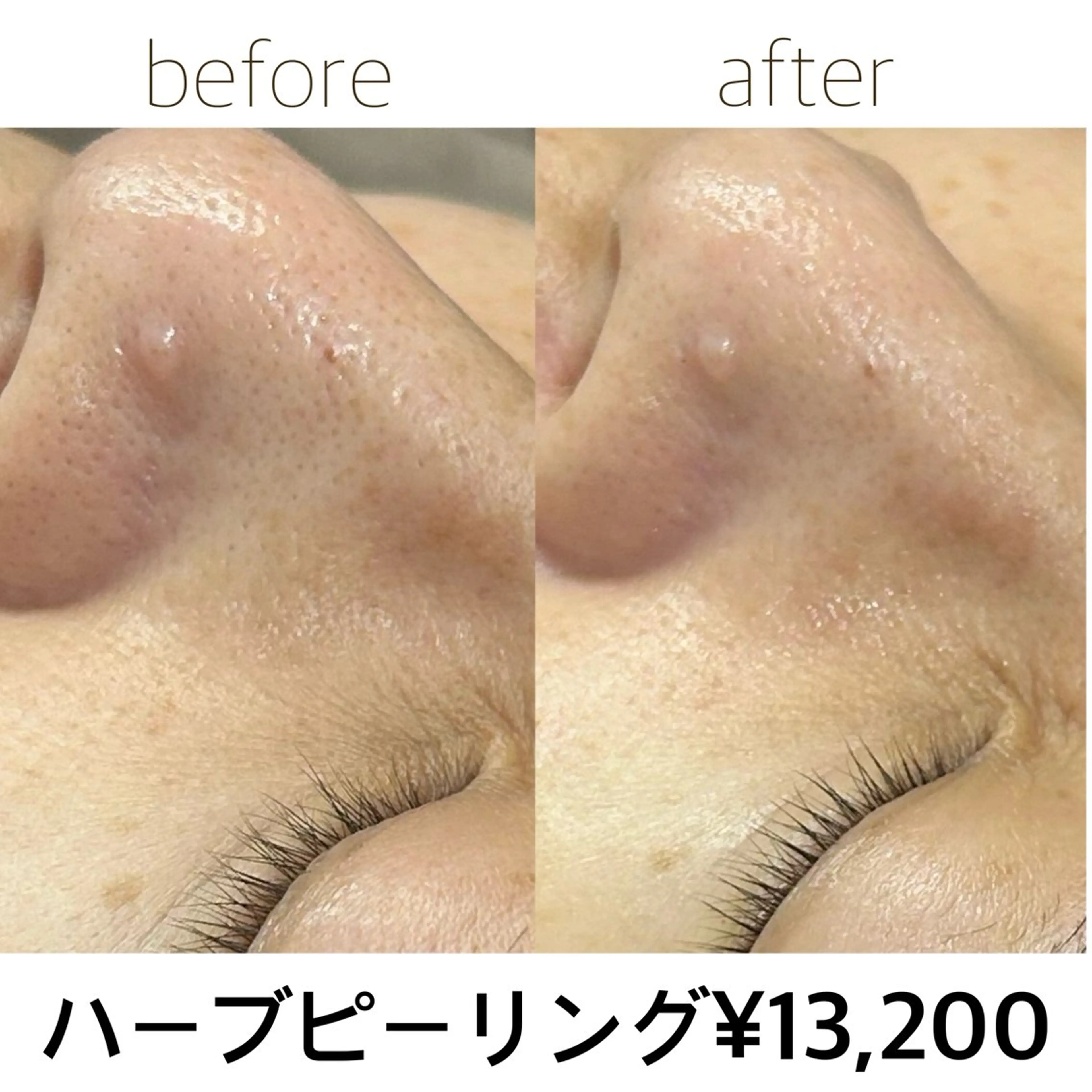 エステ 田辺🌿毛穴ケア サロンリテルナのエステ・リラクイメージ