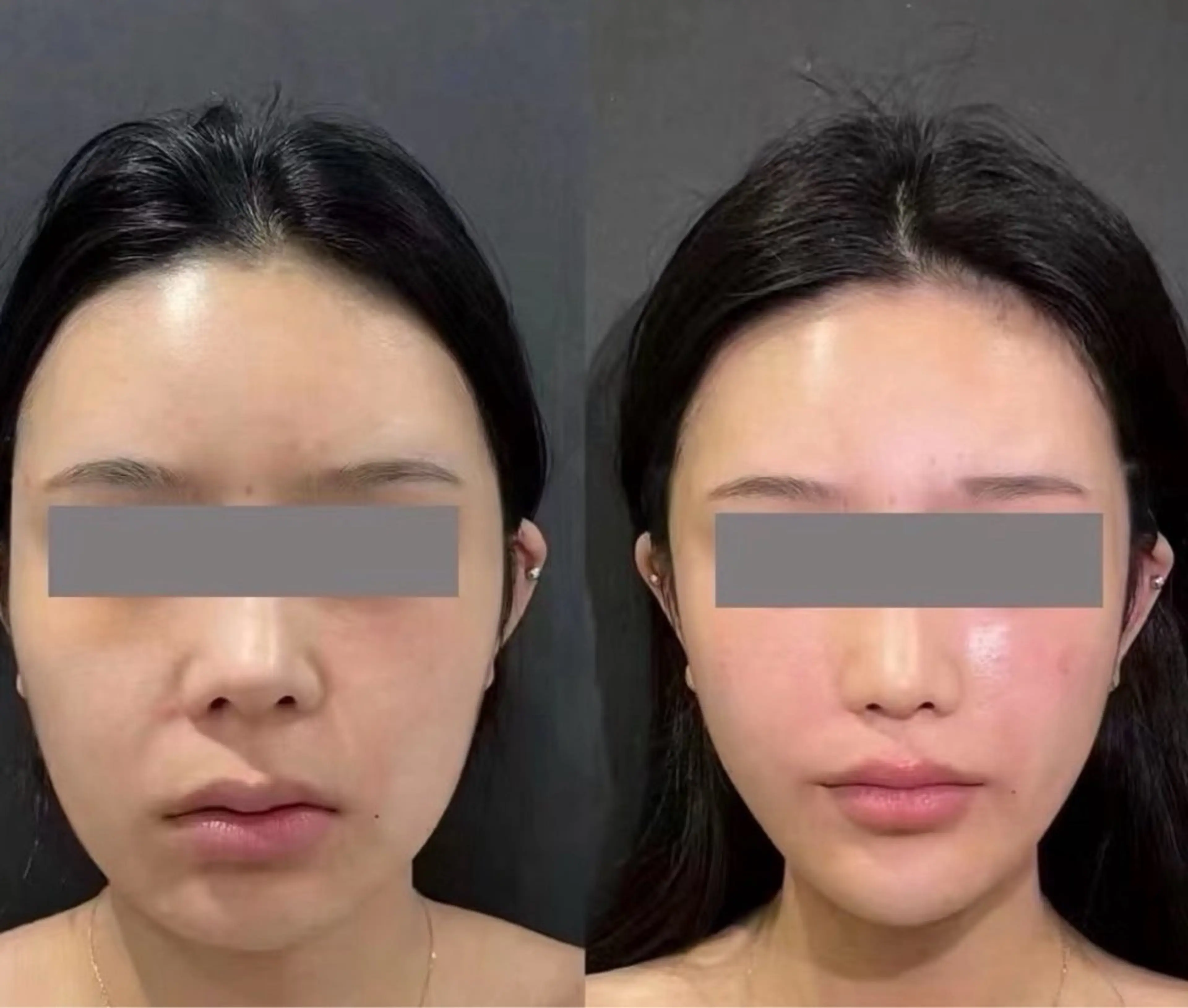 アイブロウ エステ リラク aliaハーブ水光店 エステティシャン募集のエステ・リラクイメージ