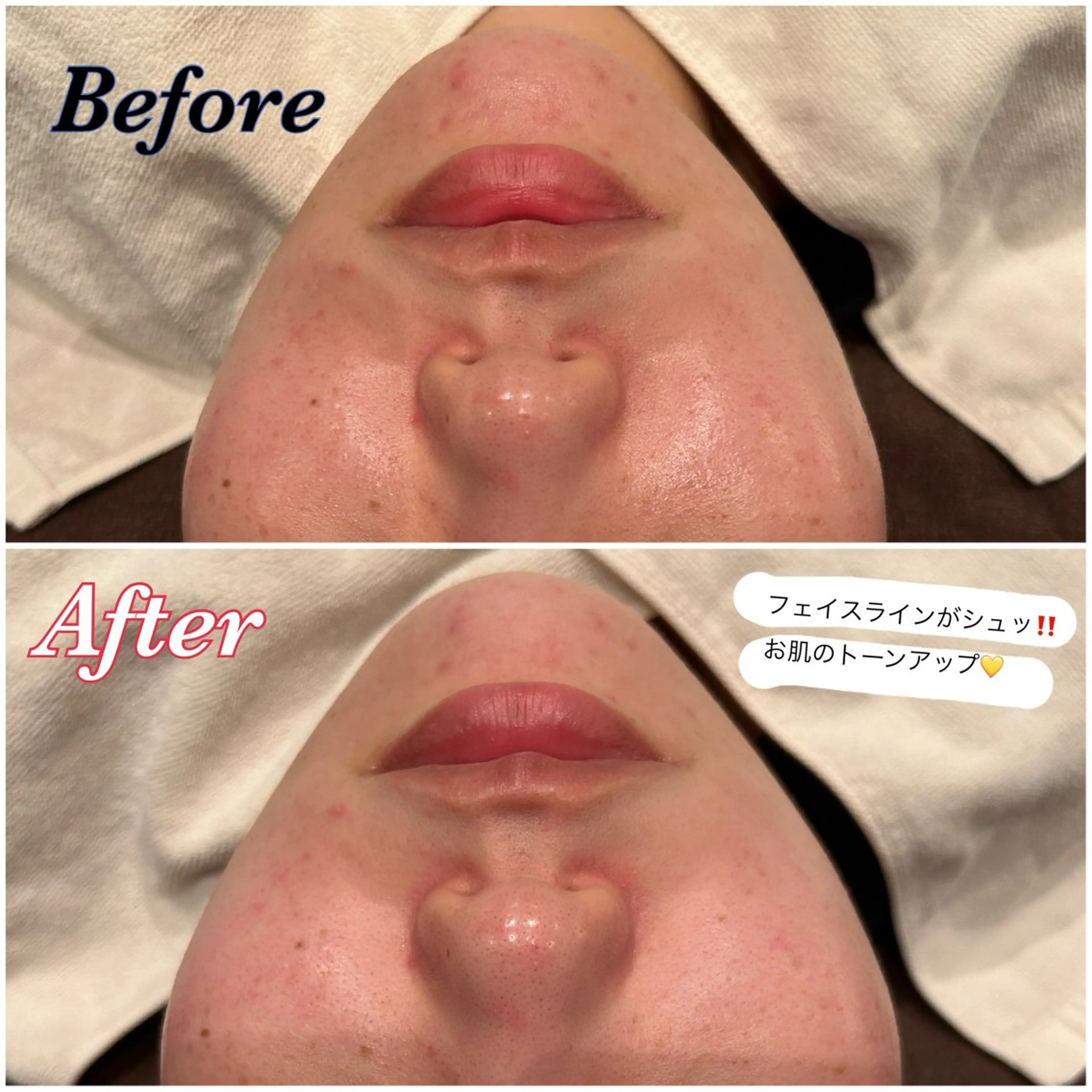 デコルテ＆フェイシャルマッサージ＆特別2種パック💙の写真