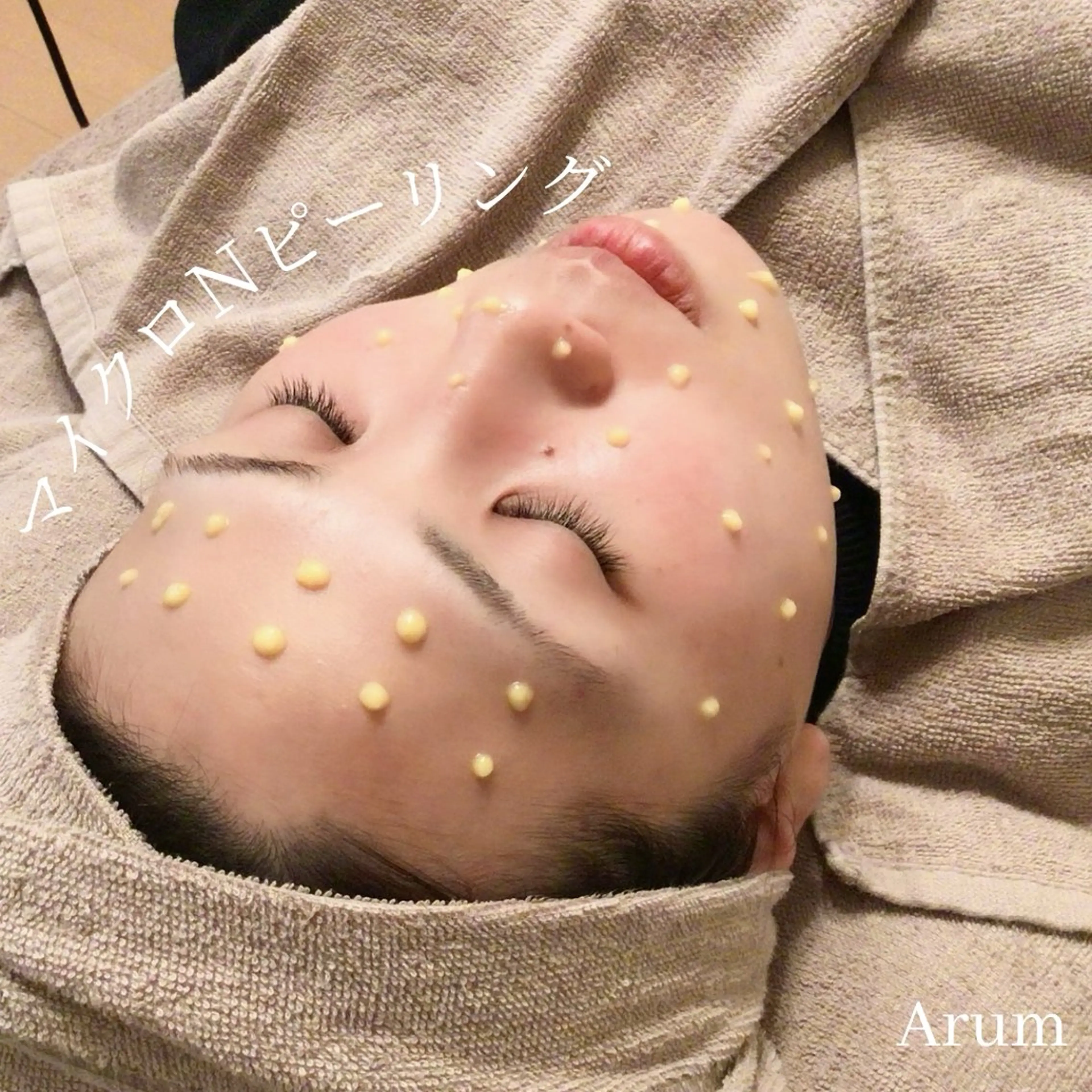 【究極のハリ艶】マイクロニードルピーリング＆鎮静パックの写真