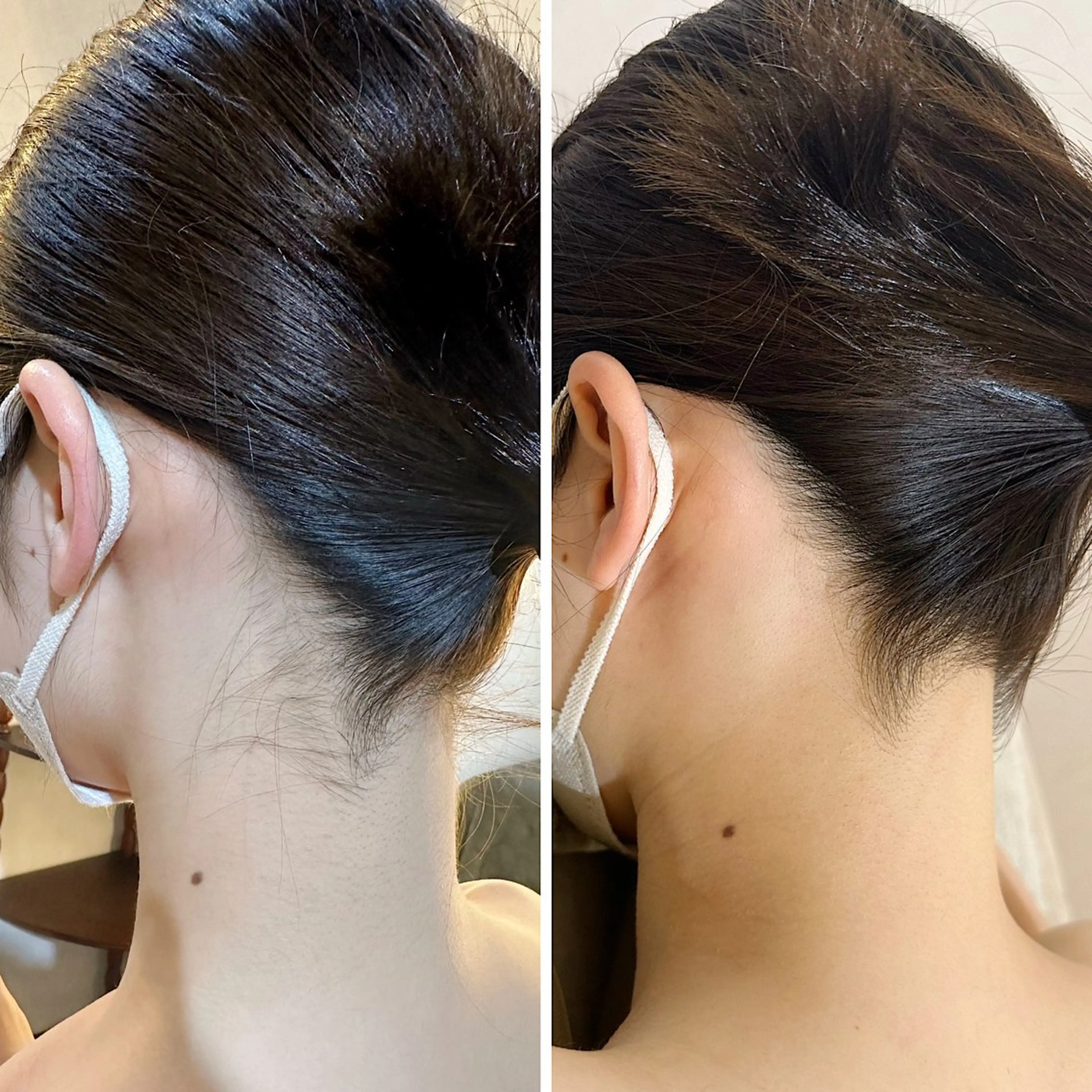 脱毛 うなじ脱毛/美肌脱毛 LABELのエステ・リラクイメージ