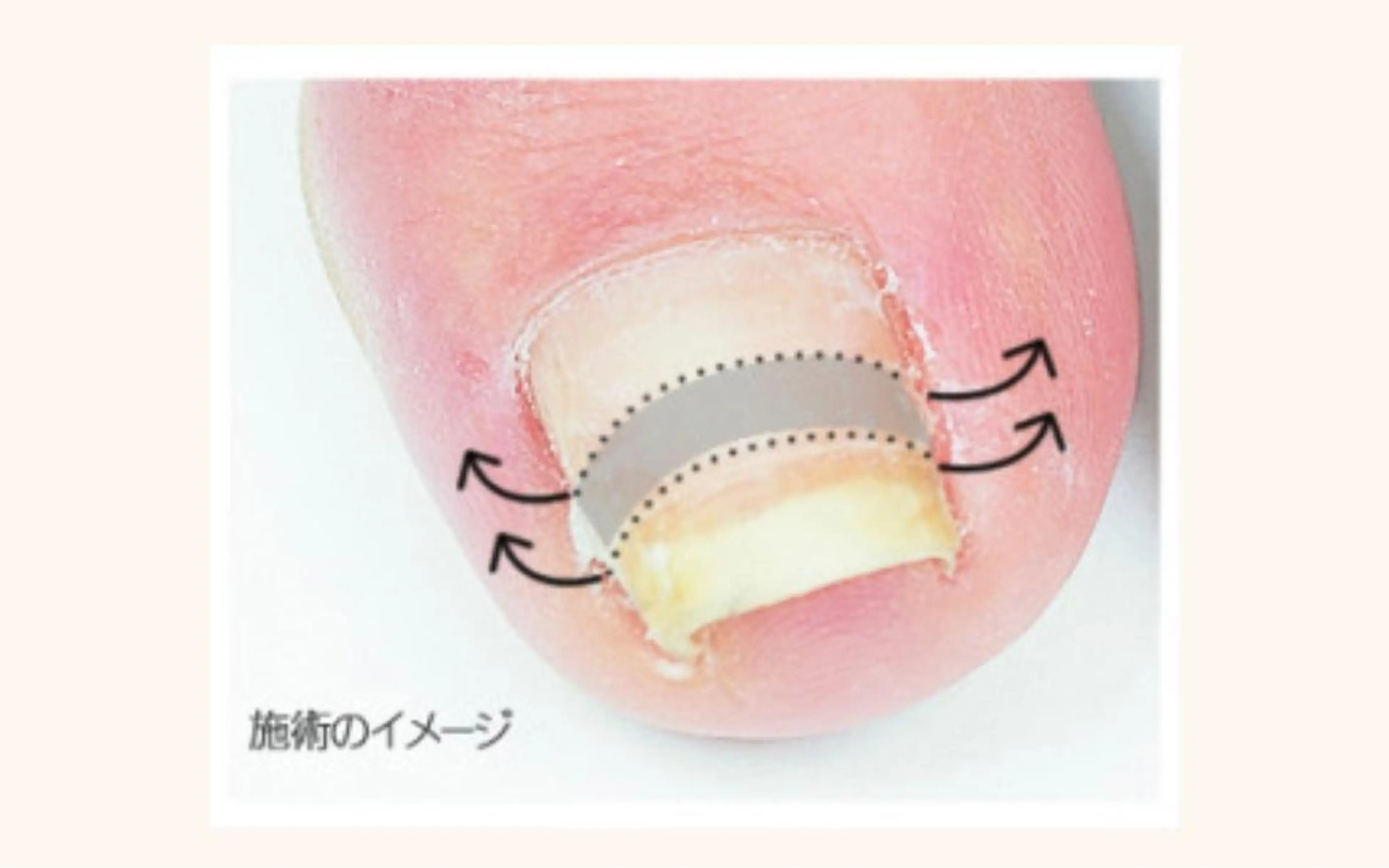 ネイル ネイルルーム チャームのネイルデザイン