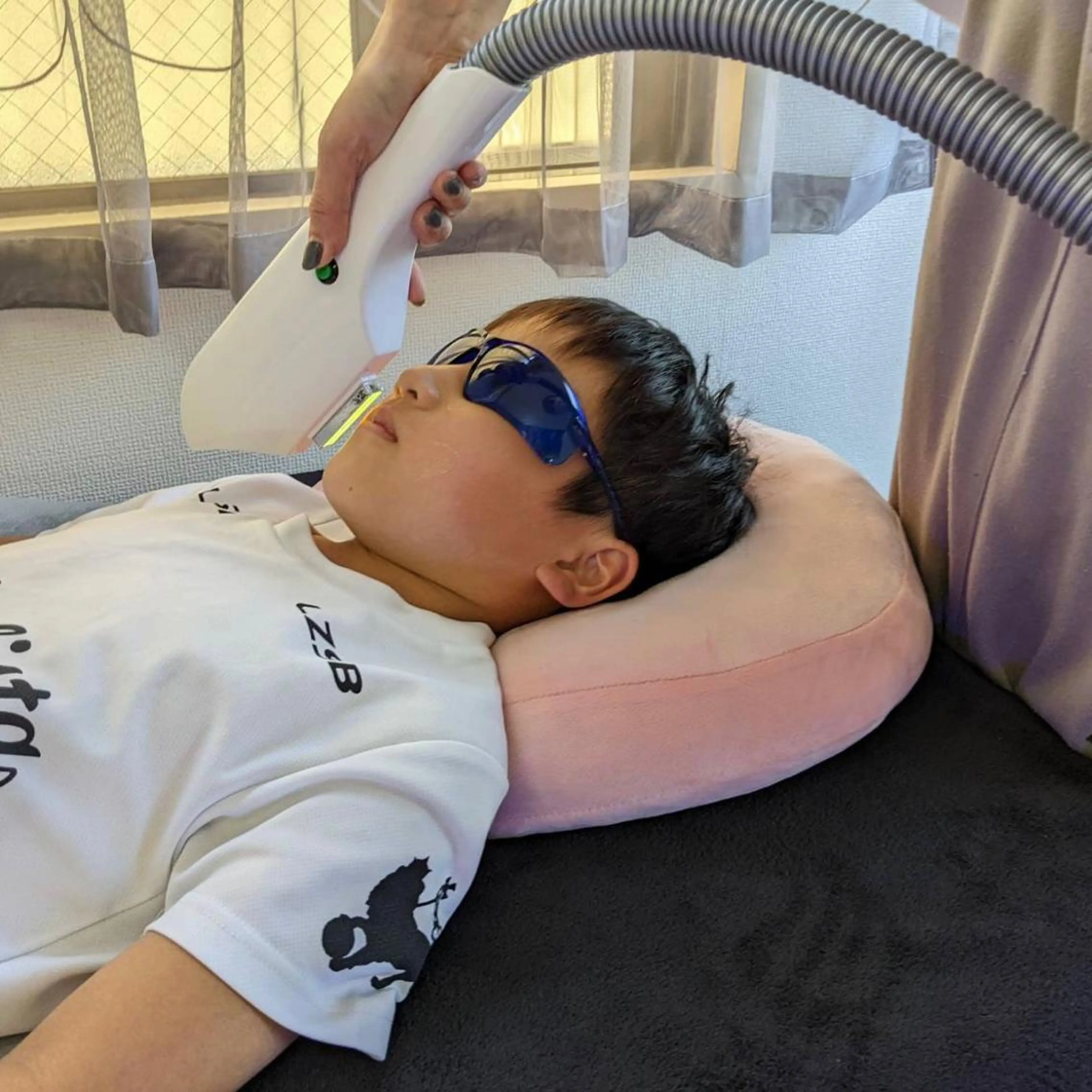 【ミニモ学割・学割U24】脱毛デビューにもオススメ。お顔脱毛の写真