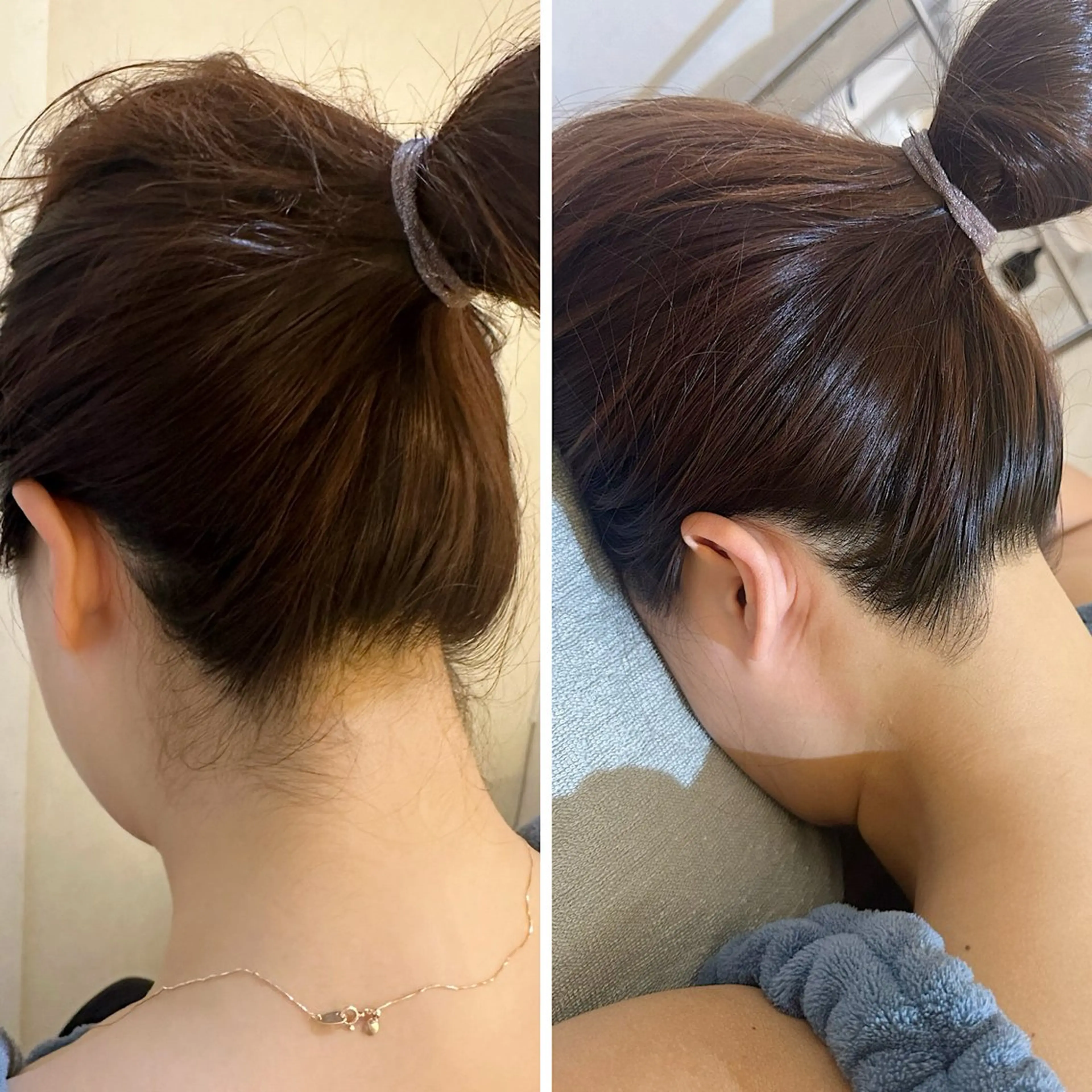 脱毛 うなじ脱毛/美肌脱毛 LABELのエステ・リラクイメージ