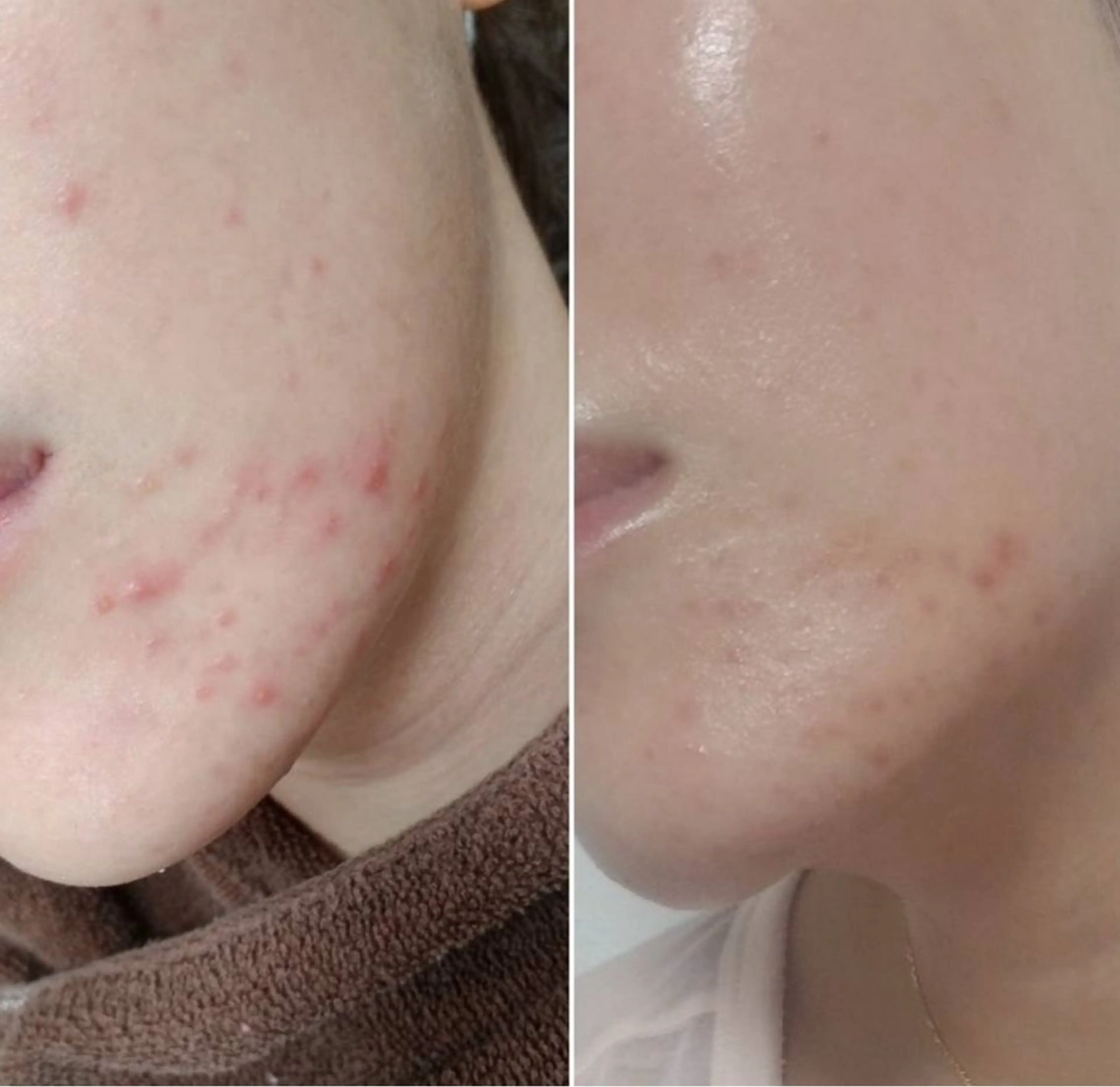 エステ 【foi】 natsumi🌼のその他イメージ