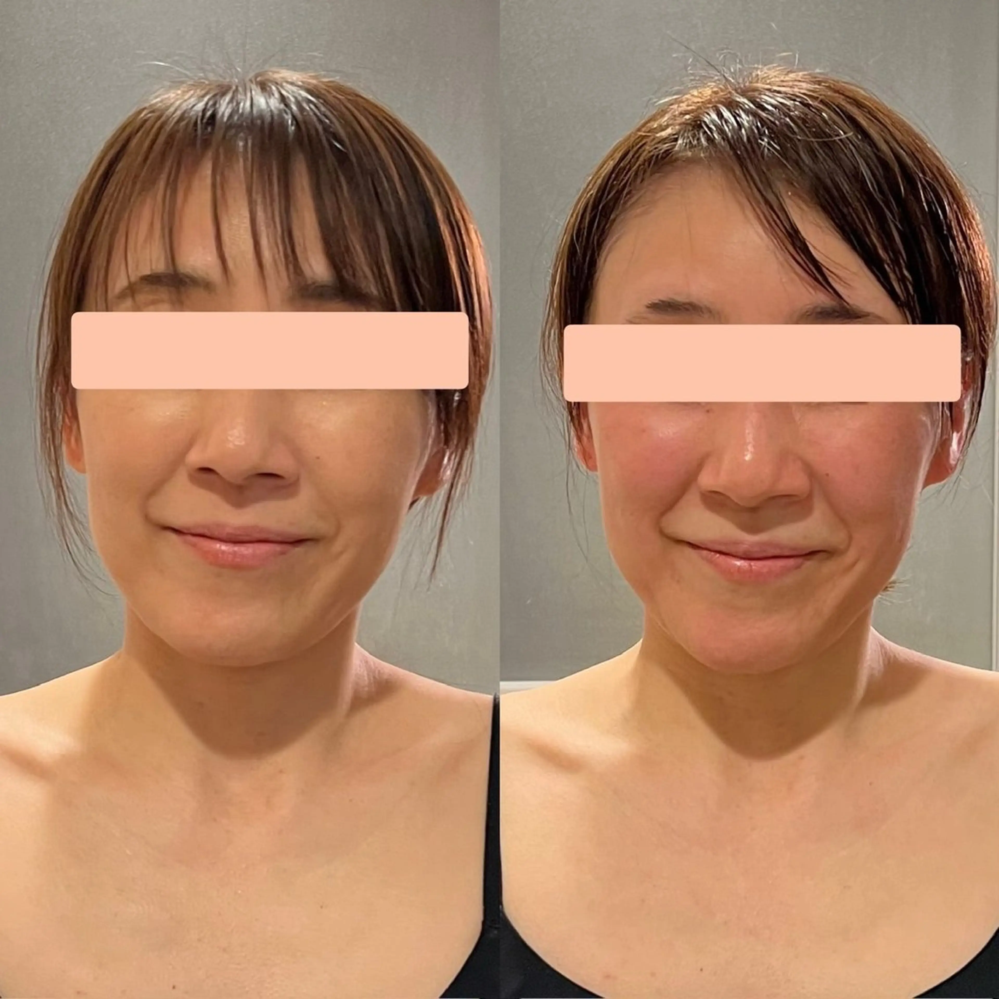 YOSAPARK jela 橋本のエステ・リラクイメージ