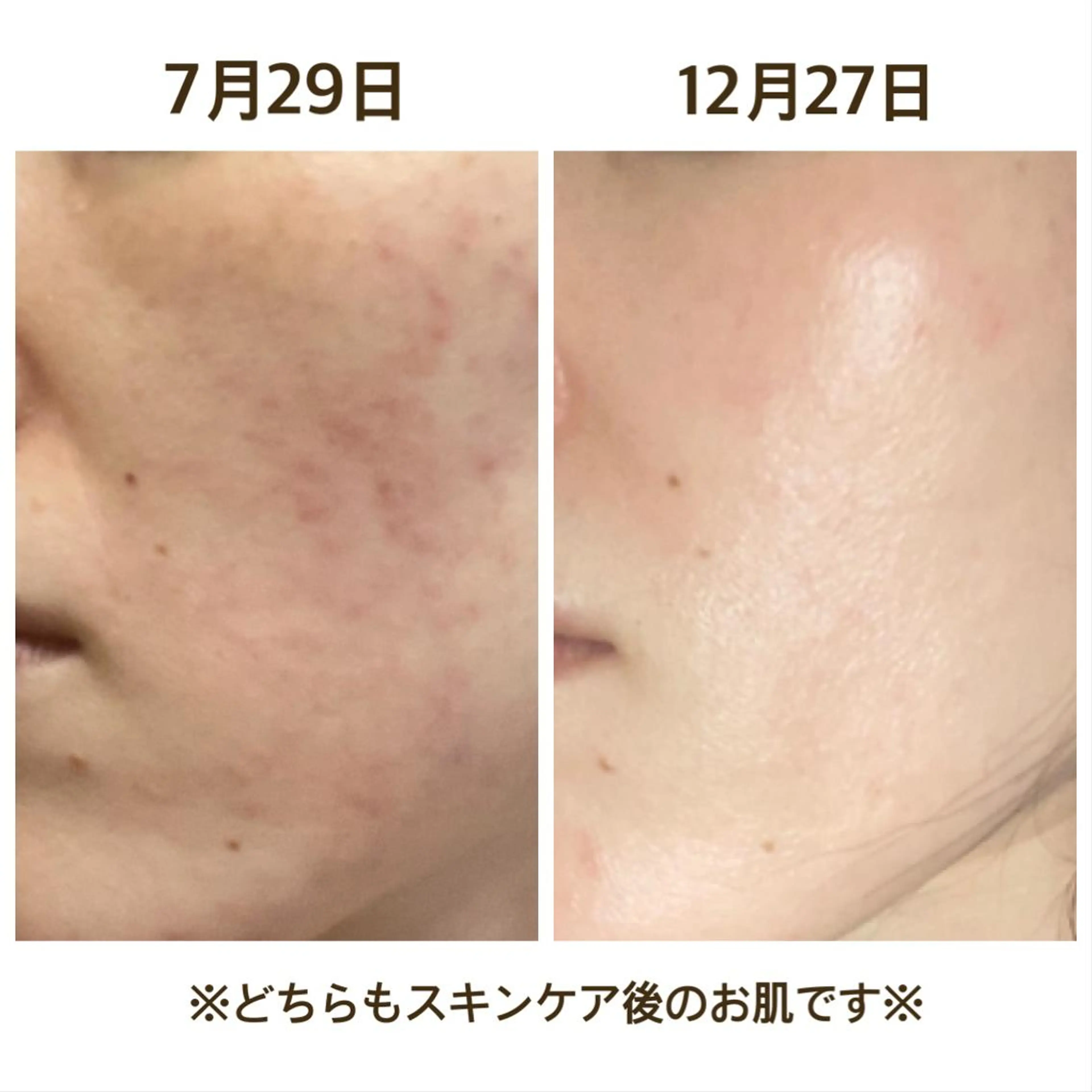 【小顔矯正】 salonaceのエステ・リラクイメージ