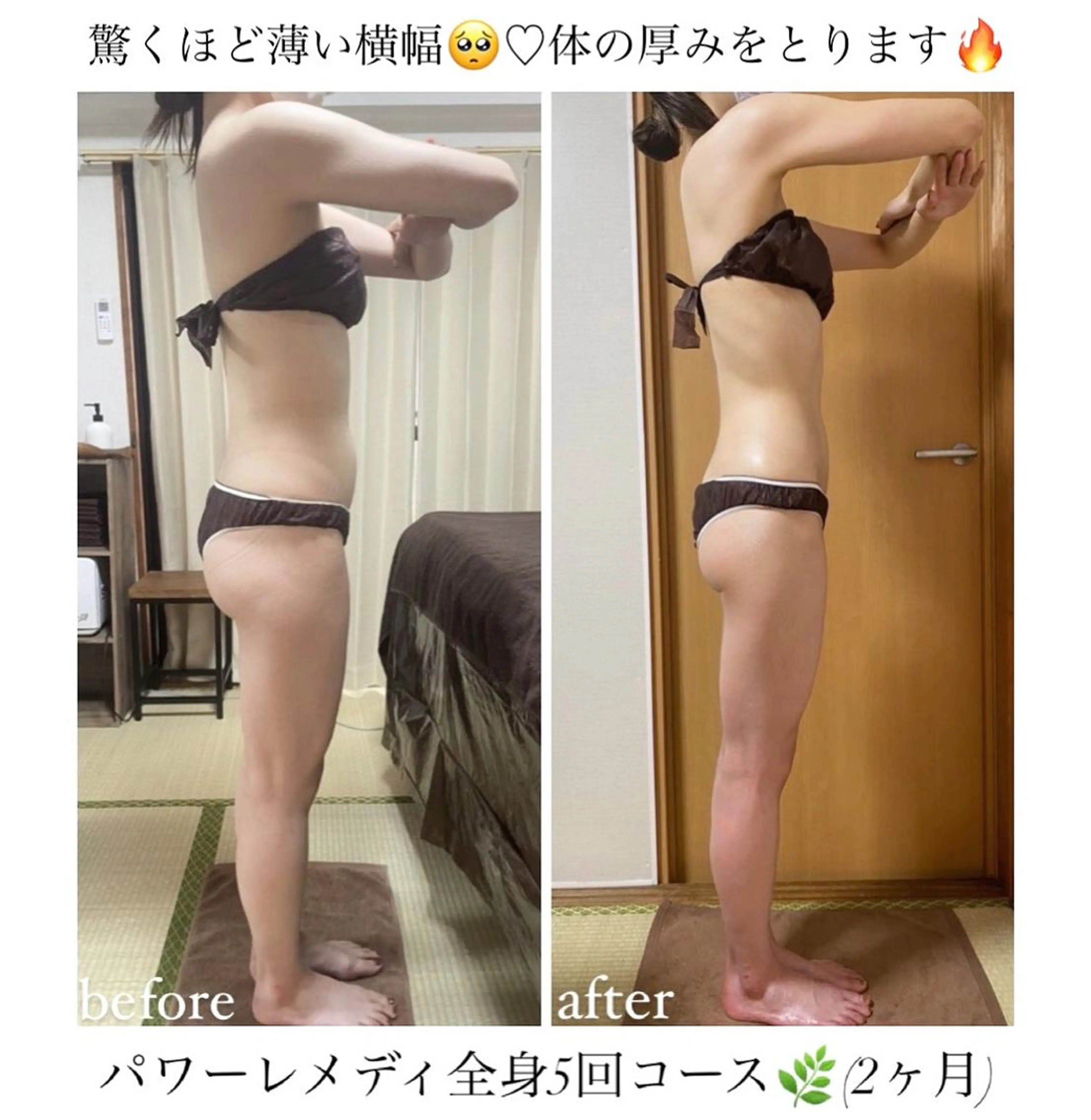 biloop所属・《本気痩せ×疲労改善 》  BILOOPのエステ・リラクイメージ