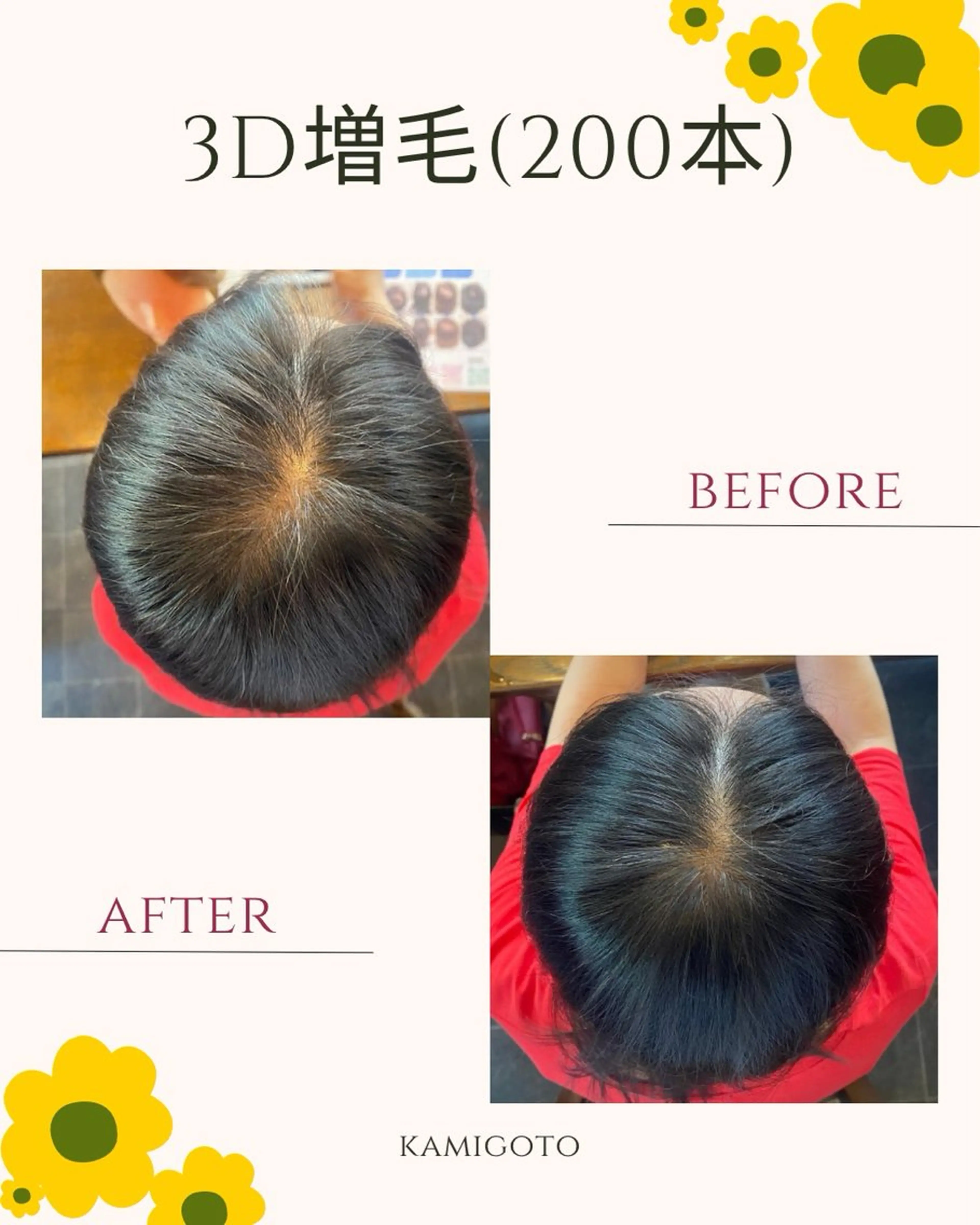 分け目・つむじ 自然増毛専門のヘアスタイル