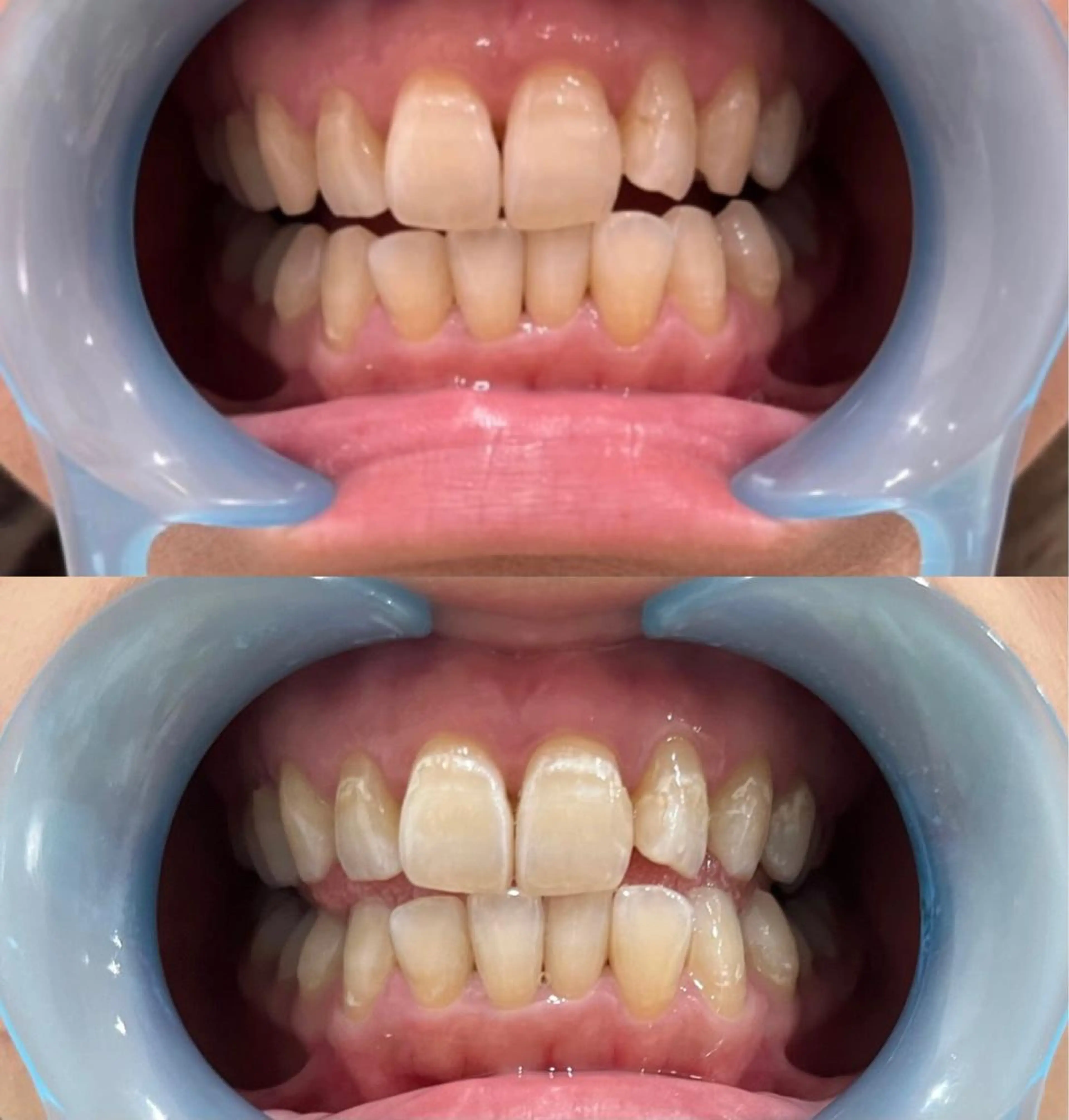 菱谷 伊津子のエステ・リラクイメージ