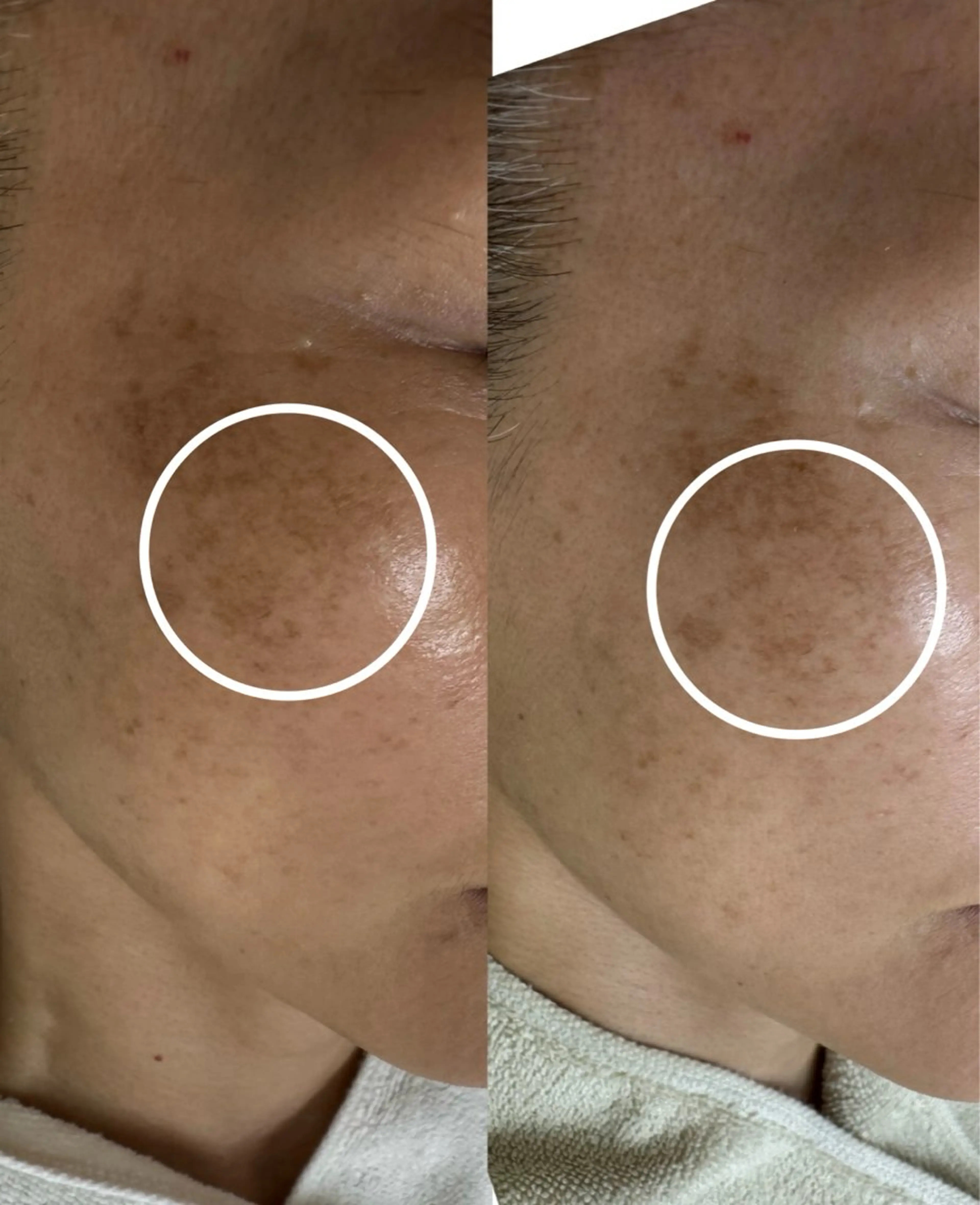 シミ毛穴専門店 yucca(ユッカ)のエステ・リラクイメージ