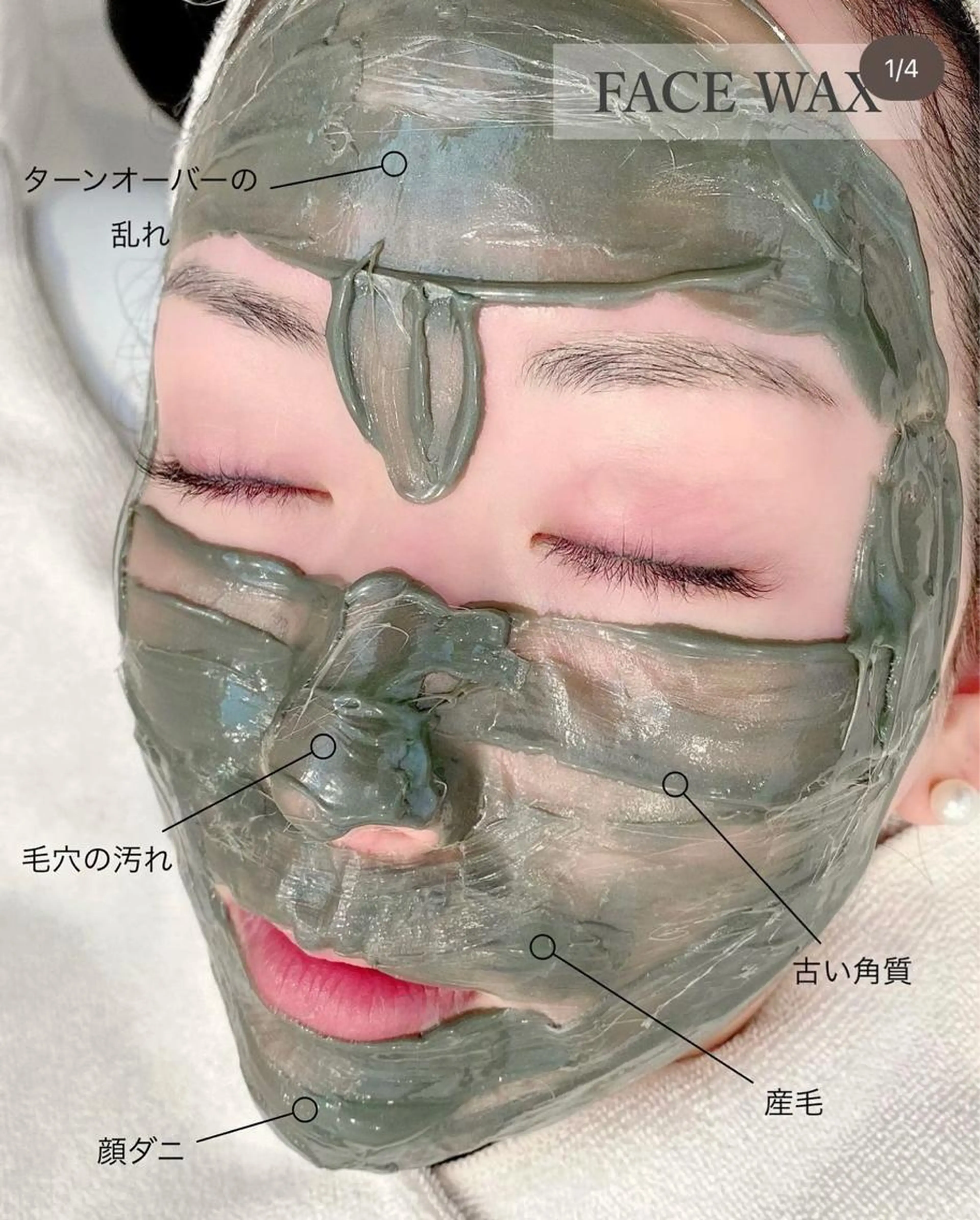 お顔全体Wax★フェイスワックスの写真