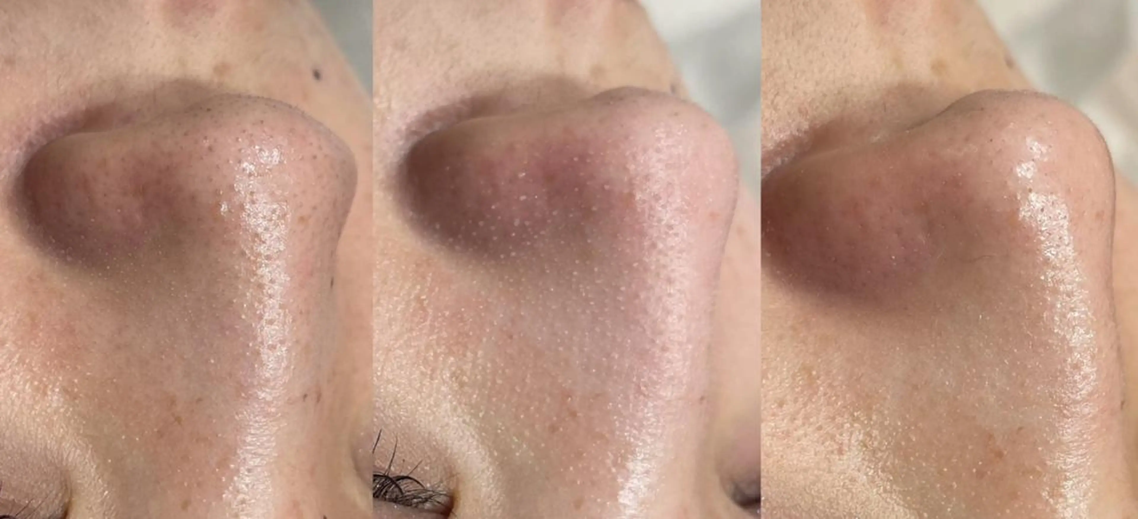 エステ NACHUL MANAのエステ・リラクイメージ