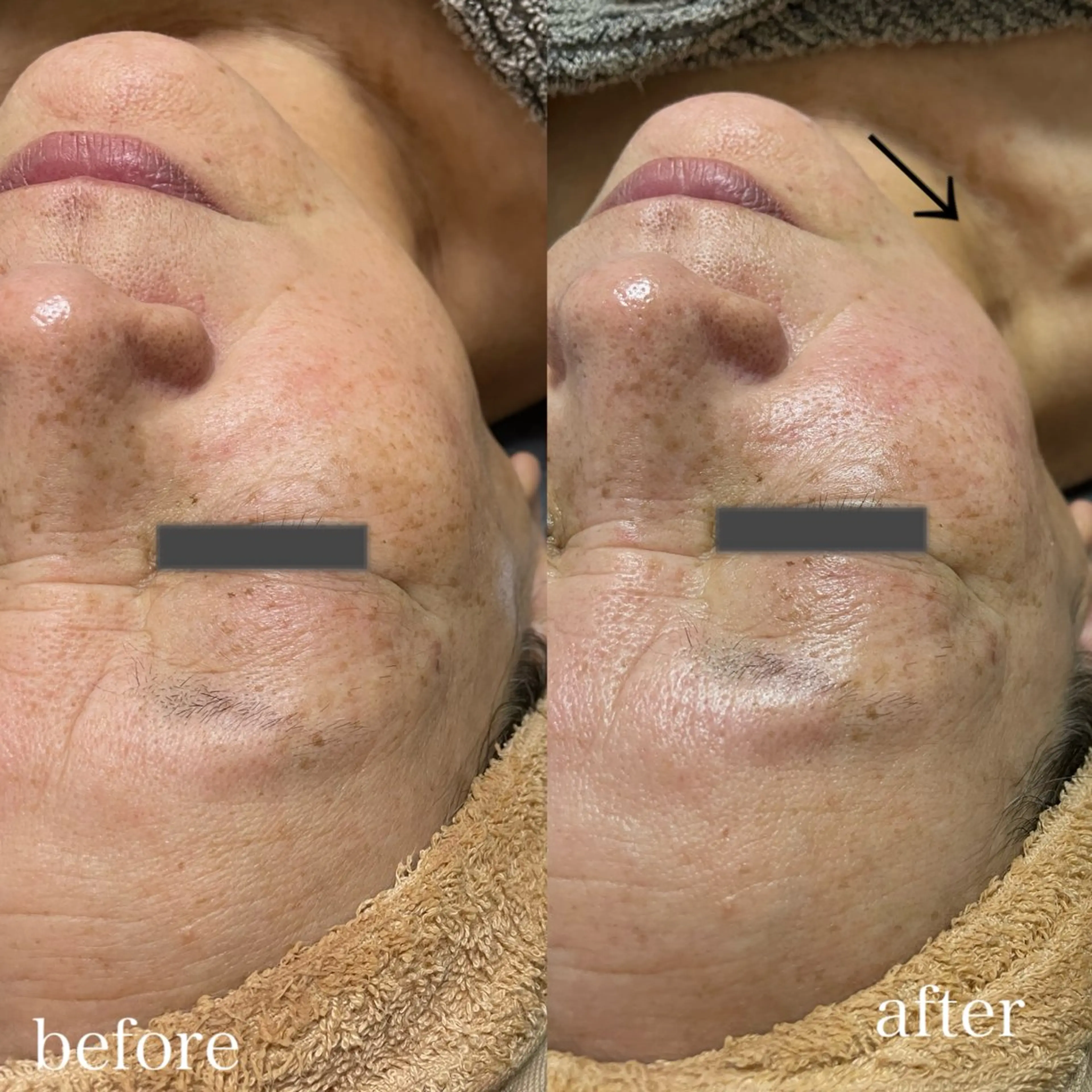 岸和田／久米田 MooMooのエステ・リラクイメージ