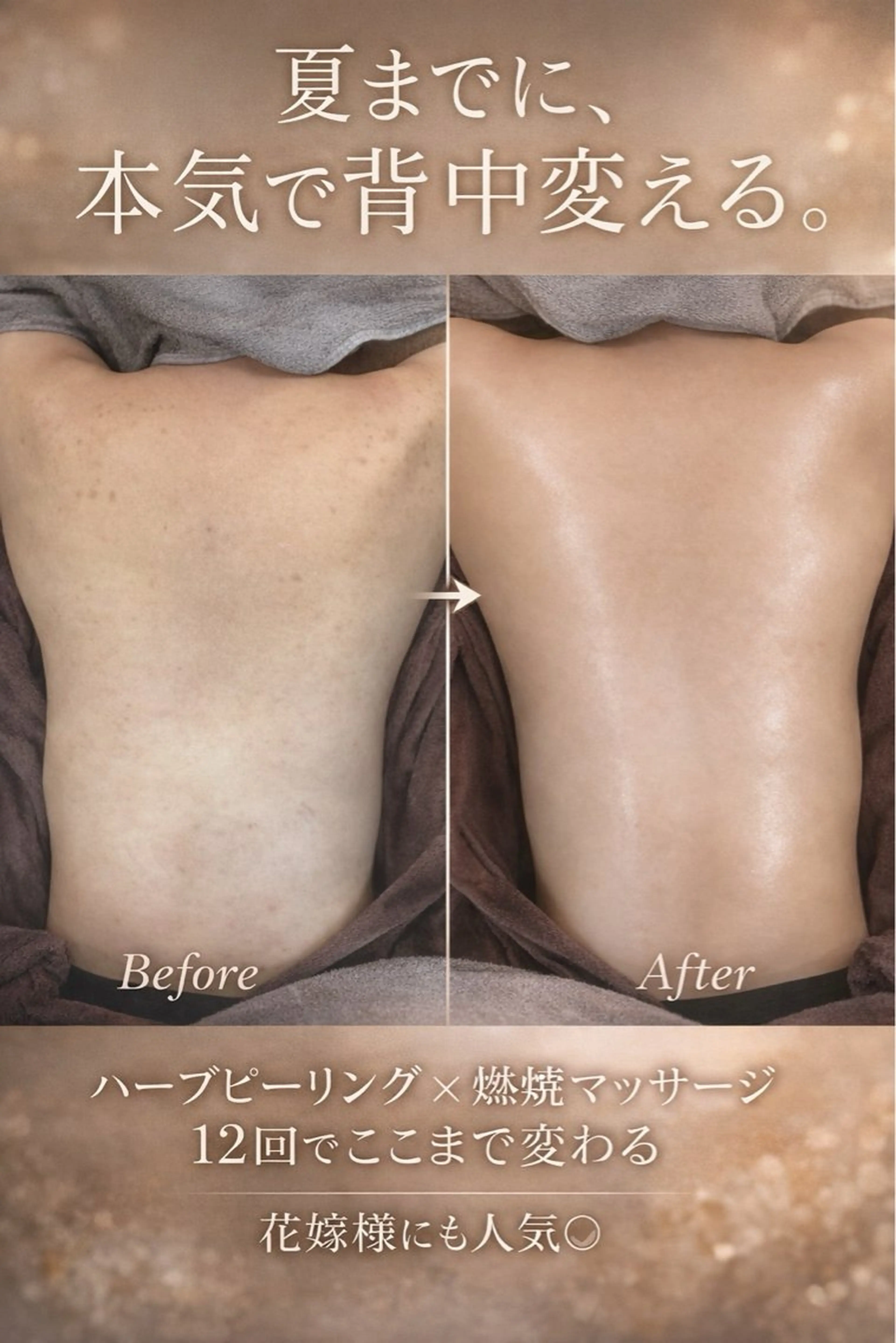 当日限定価格❤️‍🔥70%オフ背中ハーブピーリング×幹細胞パック付🌿魅せる背中への写真