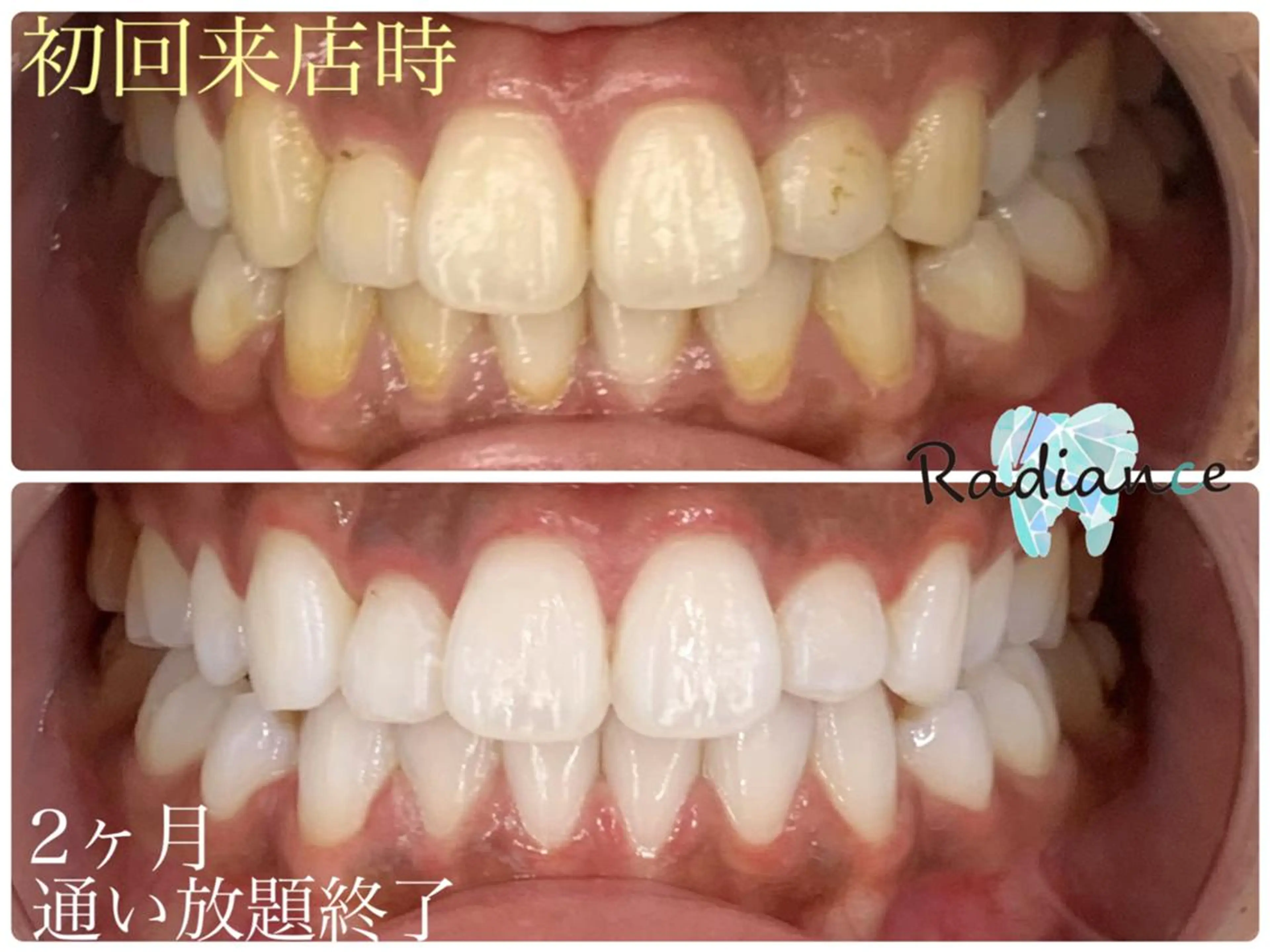 その他 札幌ホワイトニング ラディアンス菊水店のその他イメージ