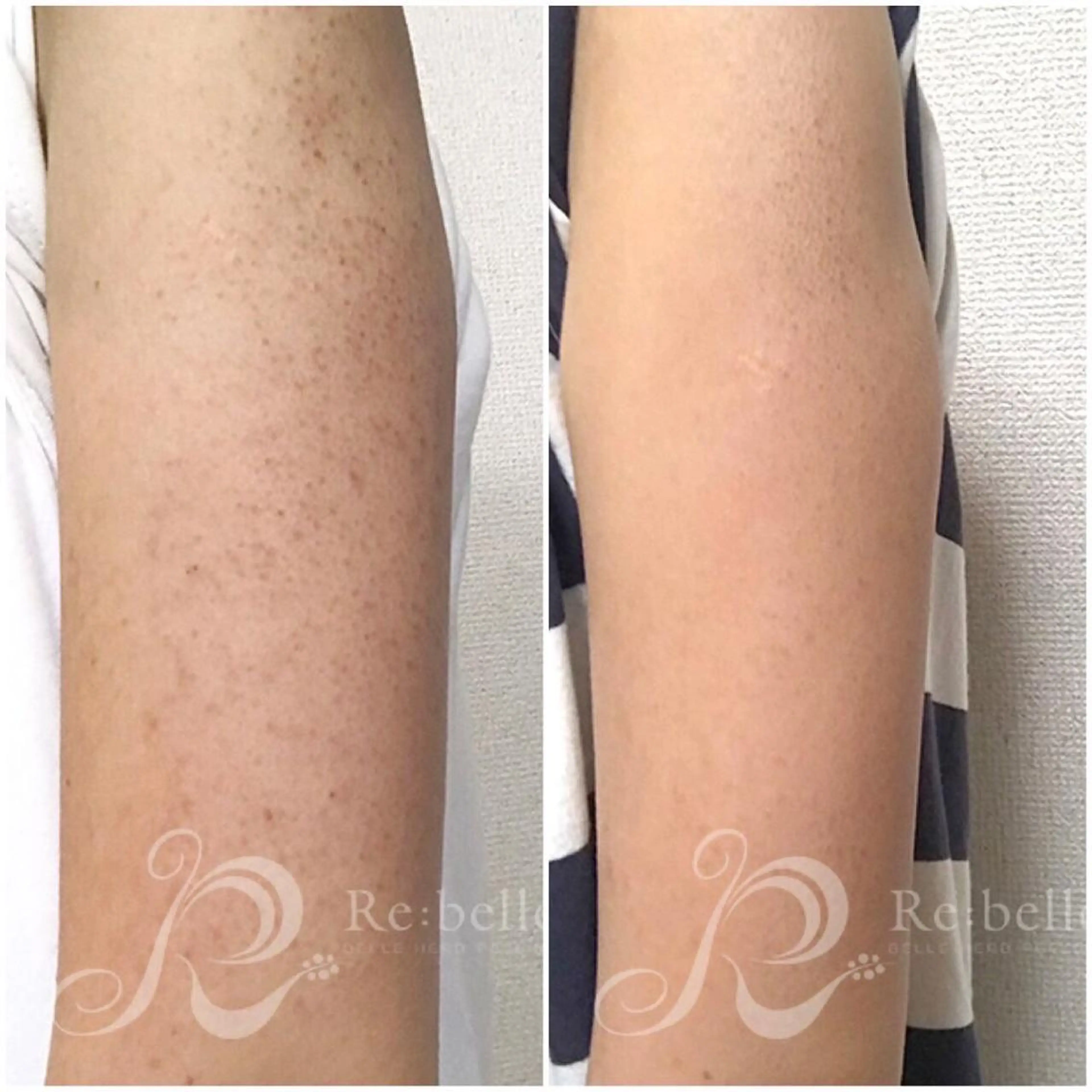 ank アンクのマツエク・マツパデザイン