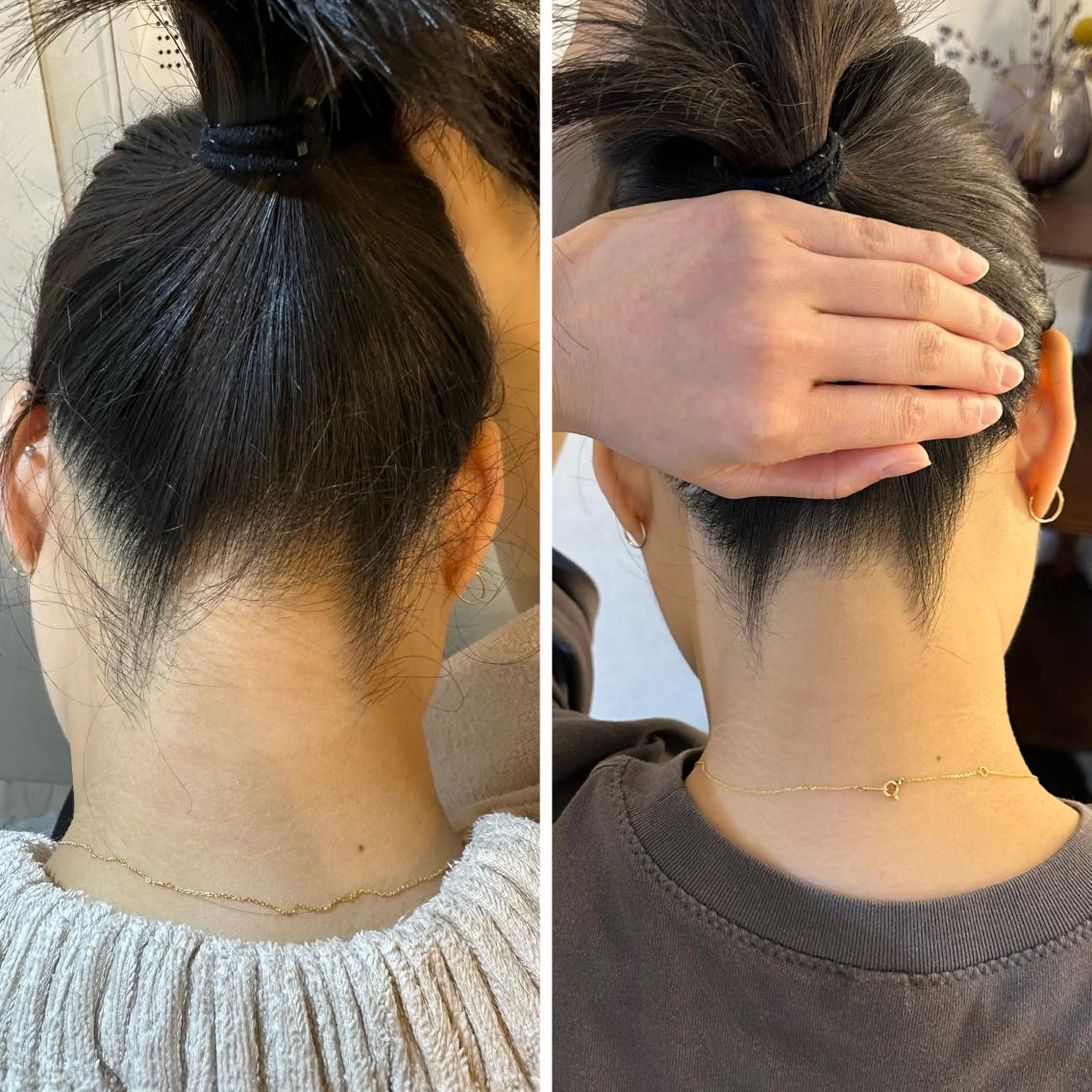 脱毛 うなじ脱毛/美肌脱毛 LABELのエステ・リラクイメージ