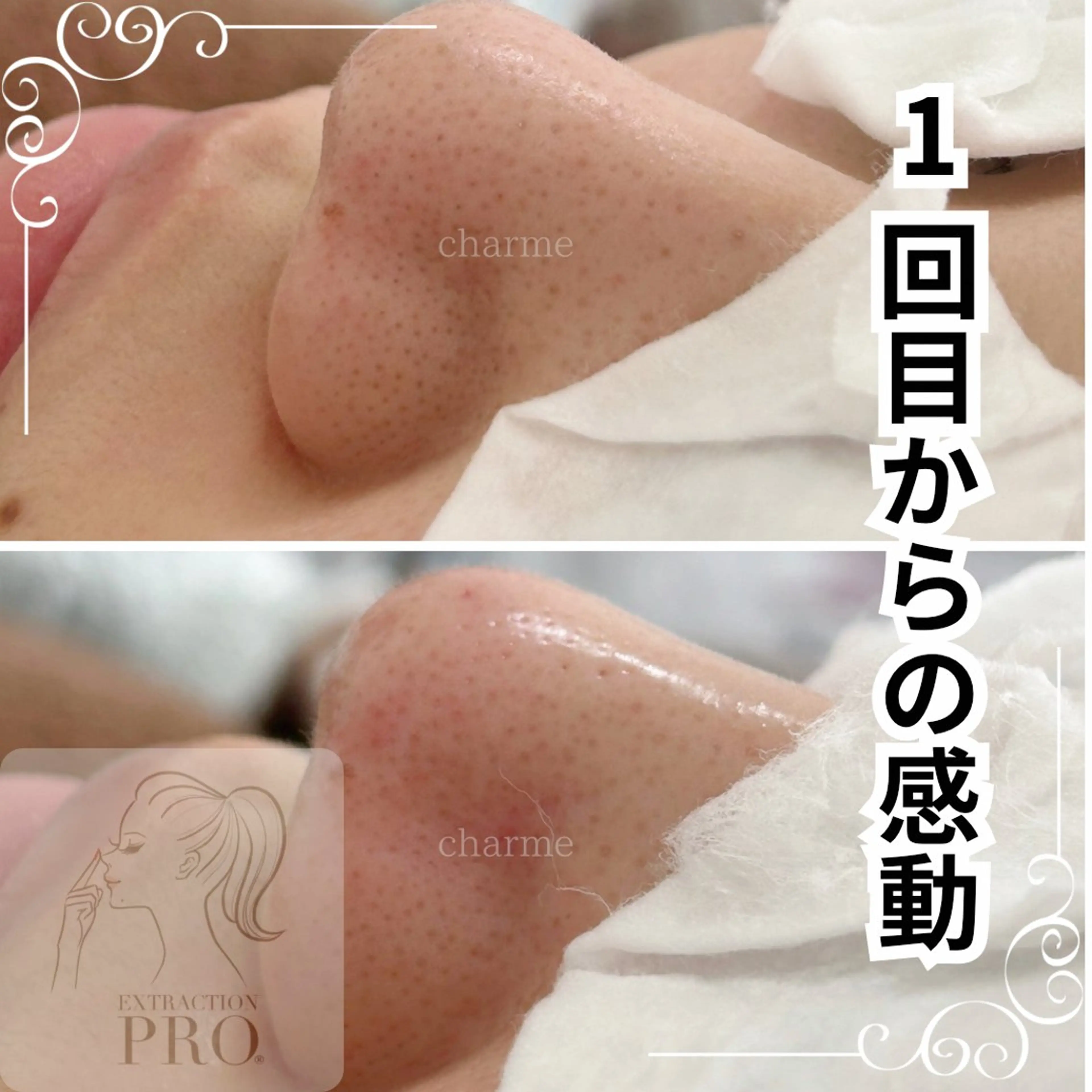 佐藤 明香のマツエク・マツパデザイン