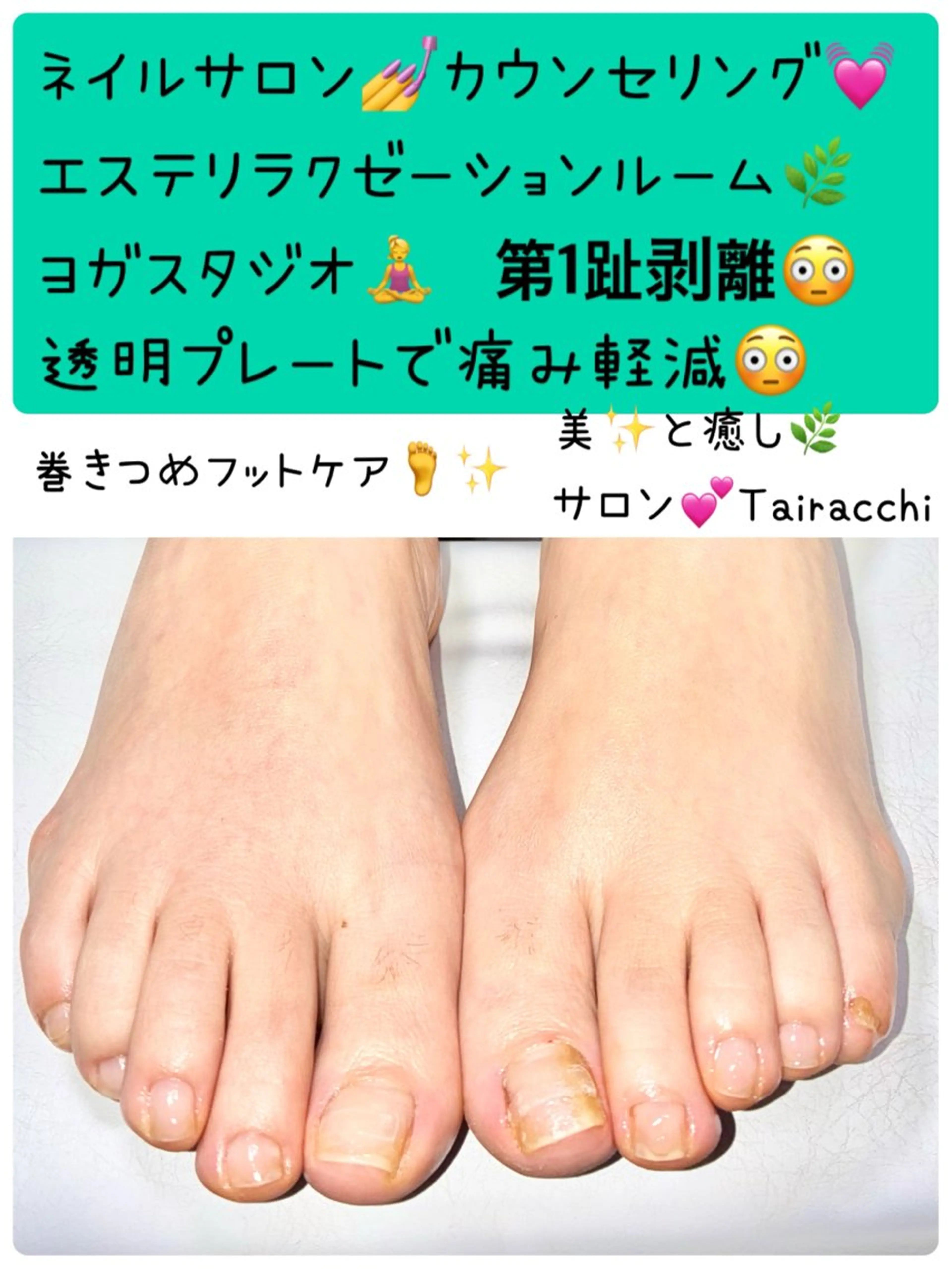 ネイル フットネイル フットネイル Tairacchi ﾀｲﾗｯﾁのエステ・リラクイメージ