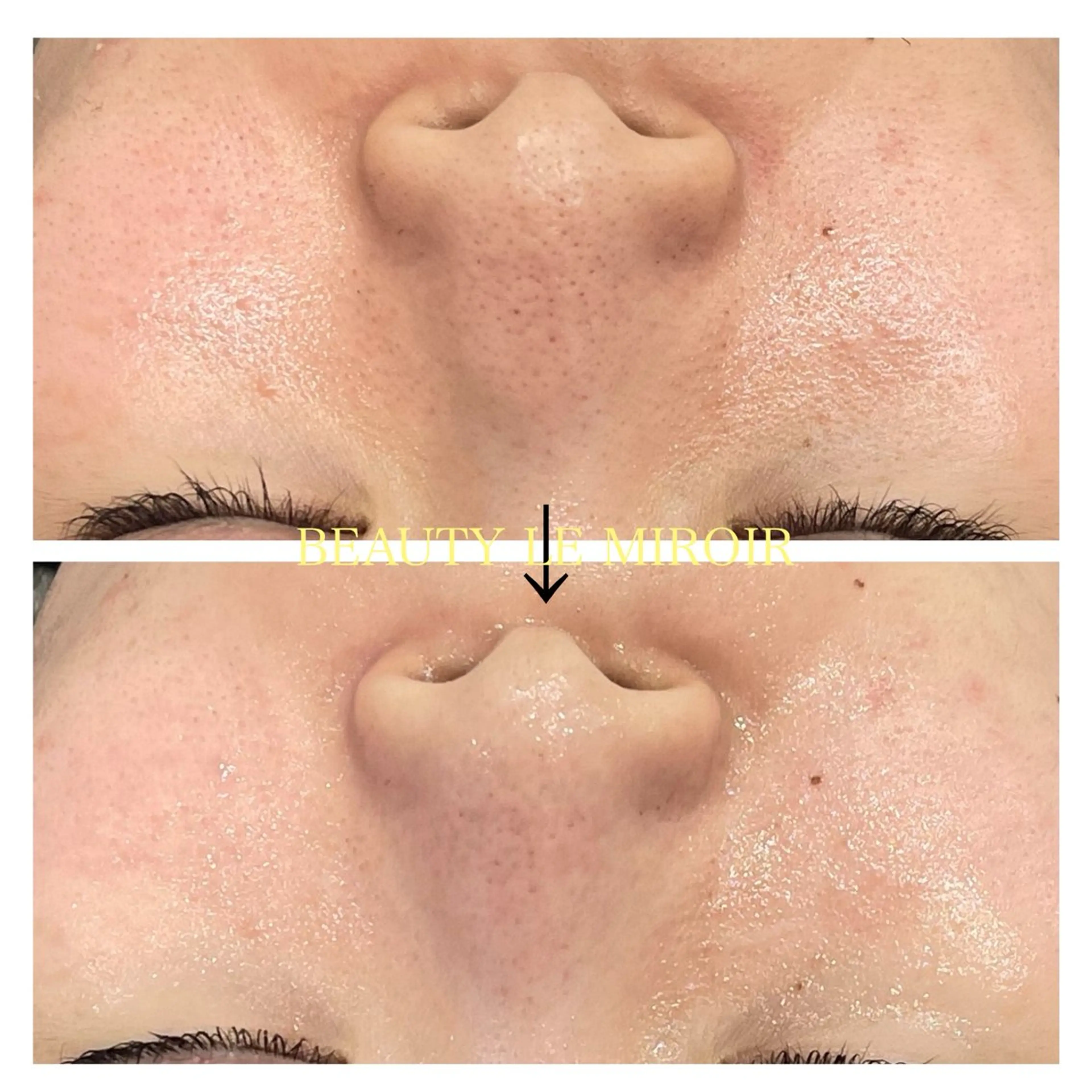 エステ ビューティー ミロワールのエステ・リラクイメージ