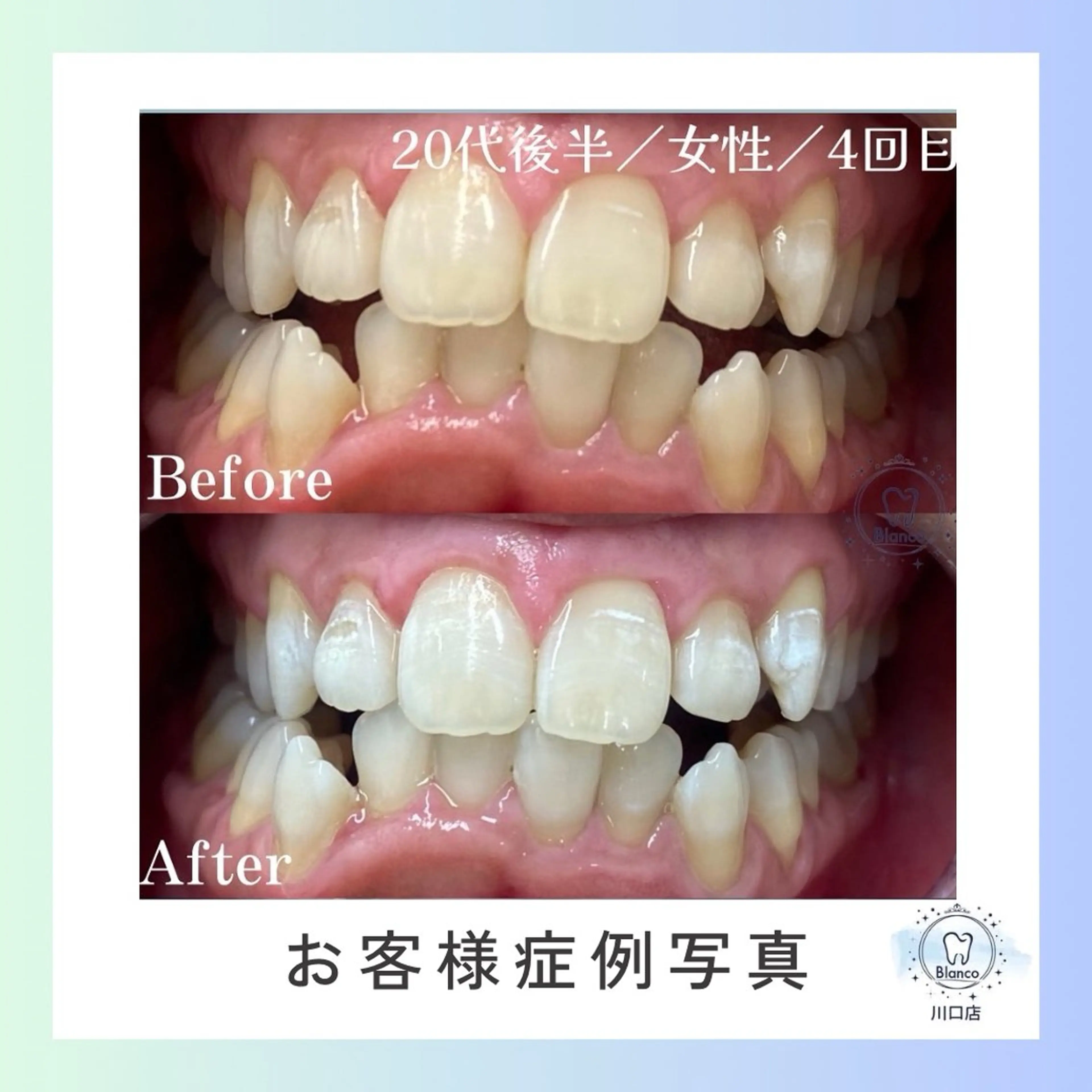 その他 Blanco 川口駅前店のその他イメージ