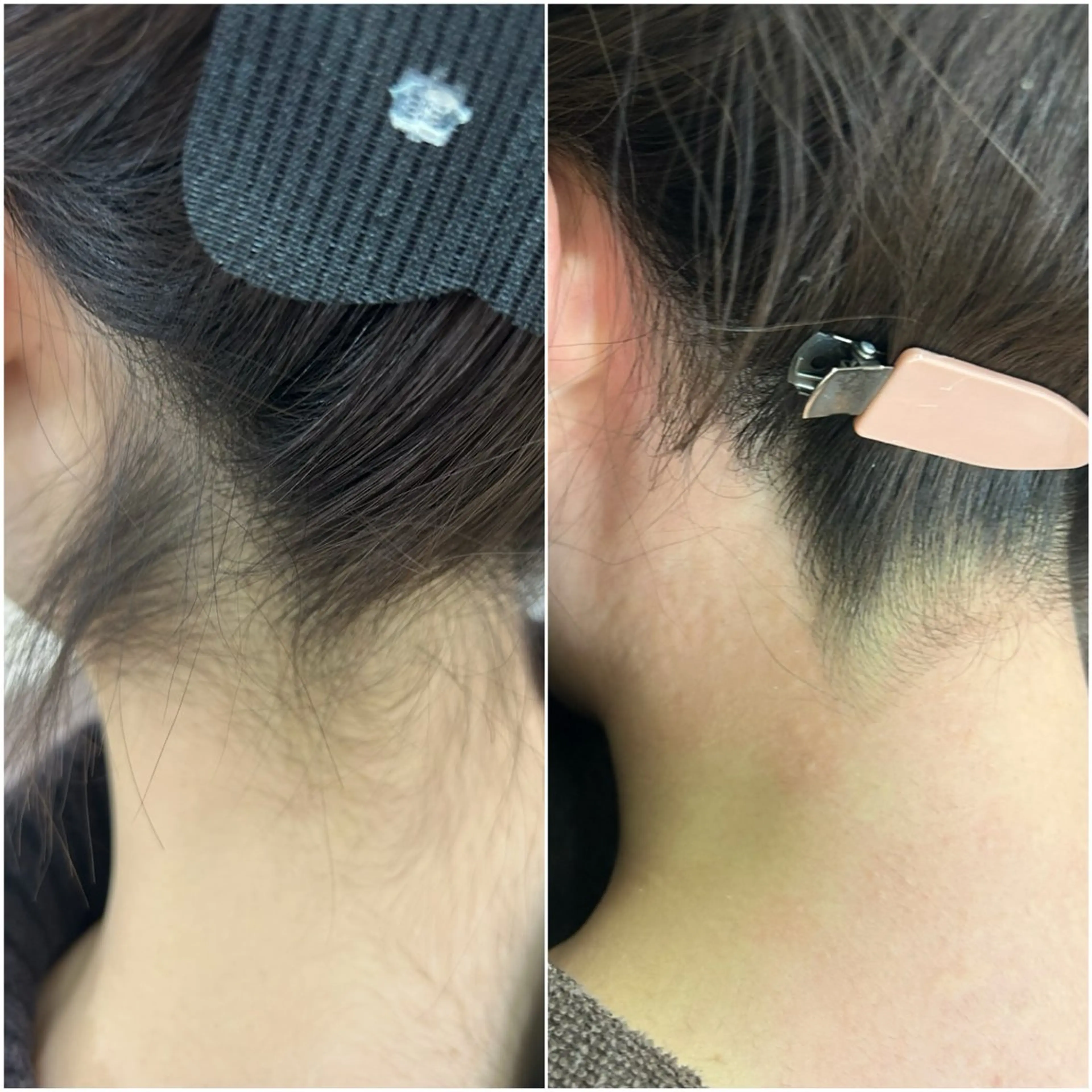 エステサロンMee. 大畑のエステ・リラクイメージ