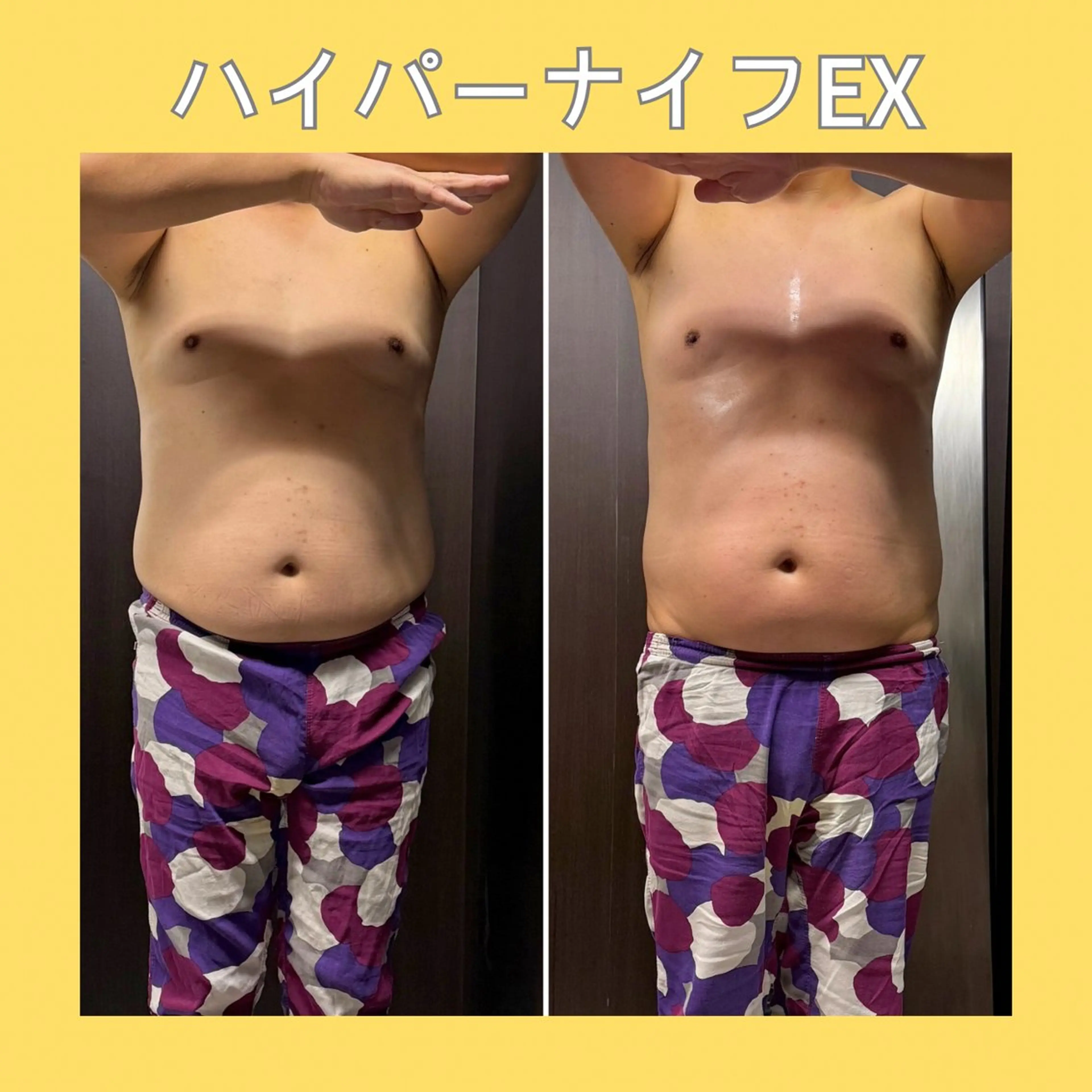 赤澤/本気痩せ・脱毛 ・ノーファンデ肌のエステ・リラクイメージ