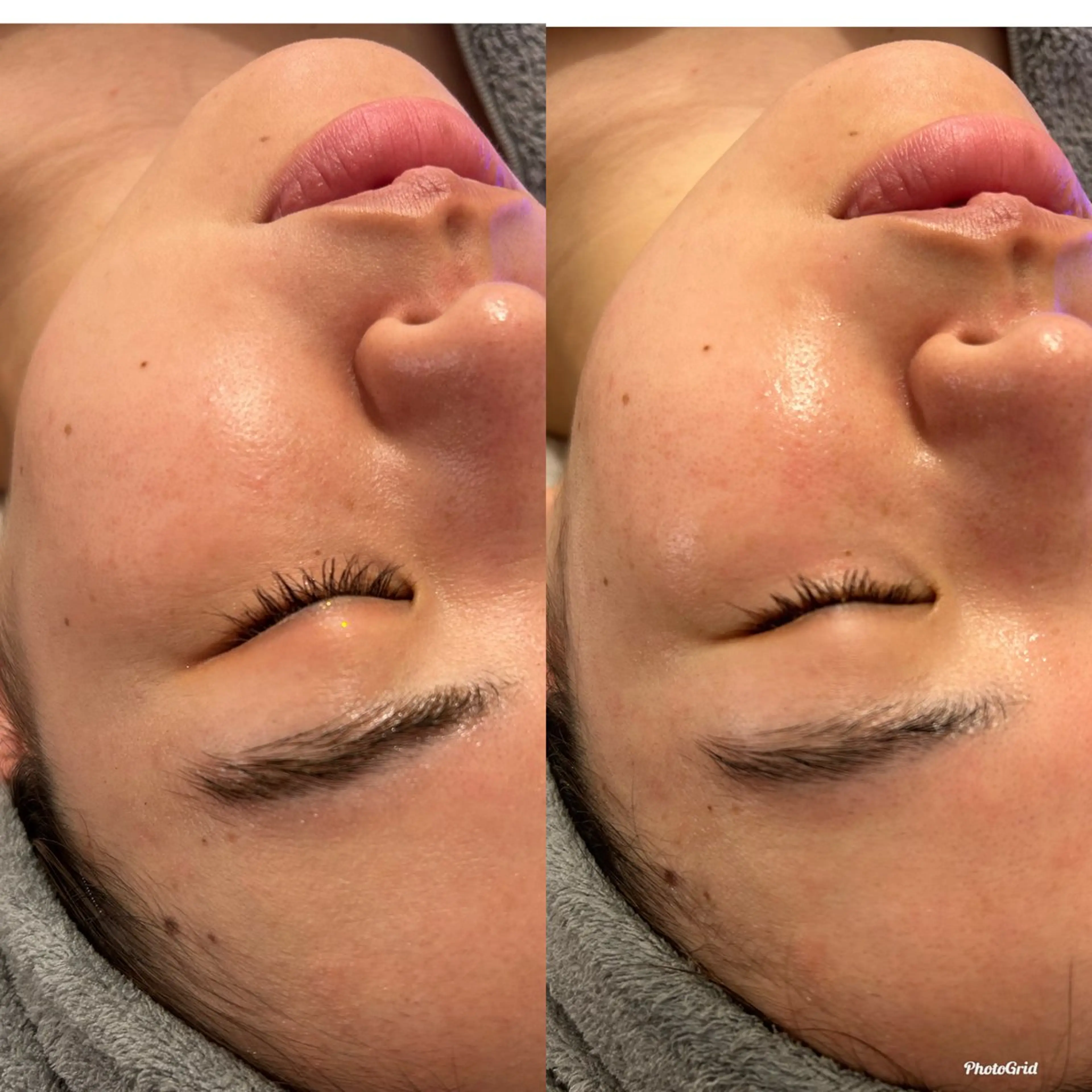 韓国肌管理ララピール クリスタルビューティのエステ・リラクイメージ