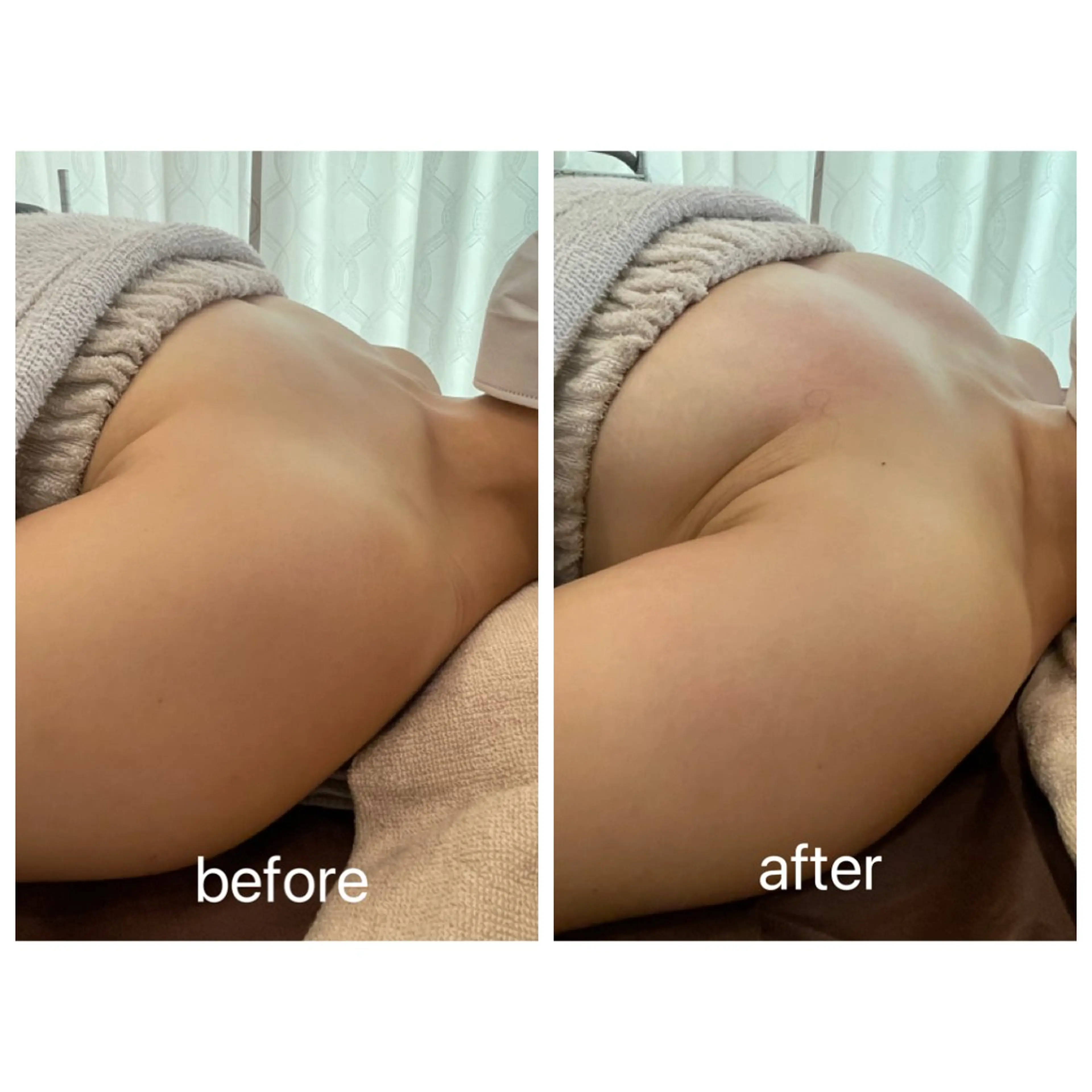 Rene 慢性疲労ケアサロンのエステ・リラクイメージ