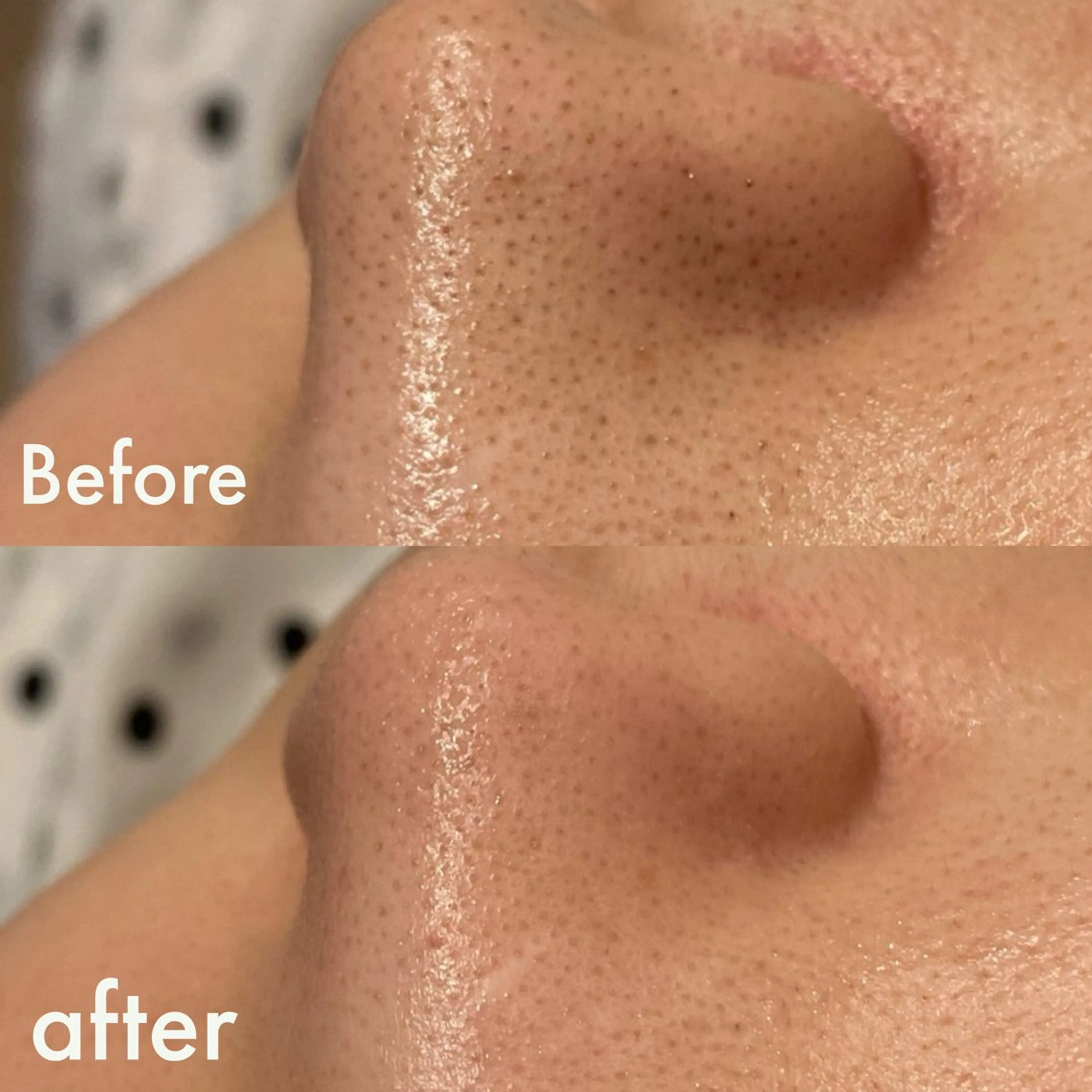 Lilyboo 池袋のエステ・リラクイメージ