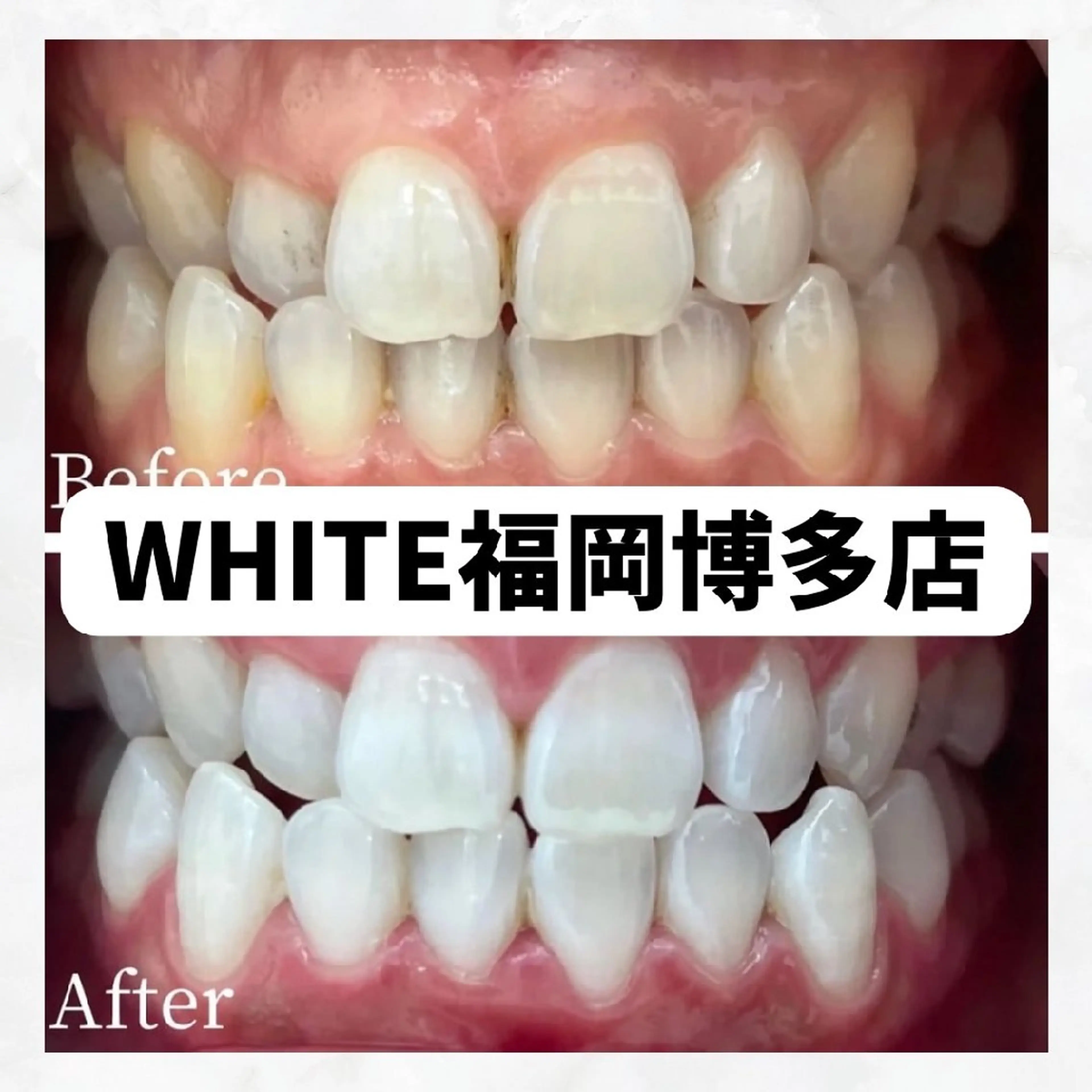 メンズ その他 セルフホワイトニング WHITE福岡博多店のエステ・リラクイメージ