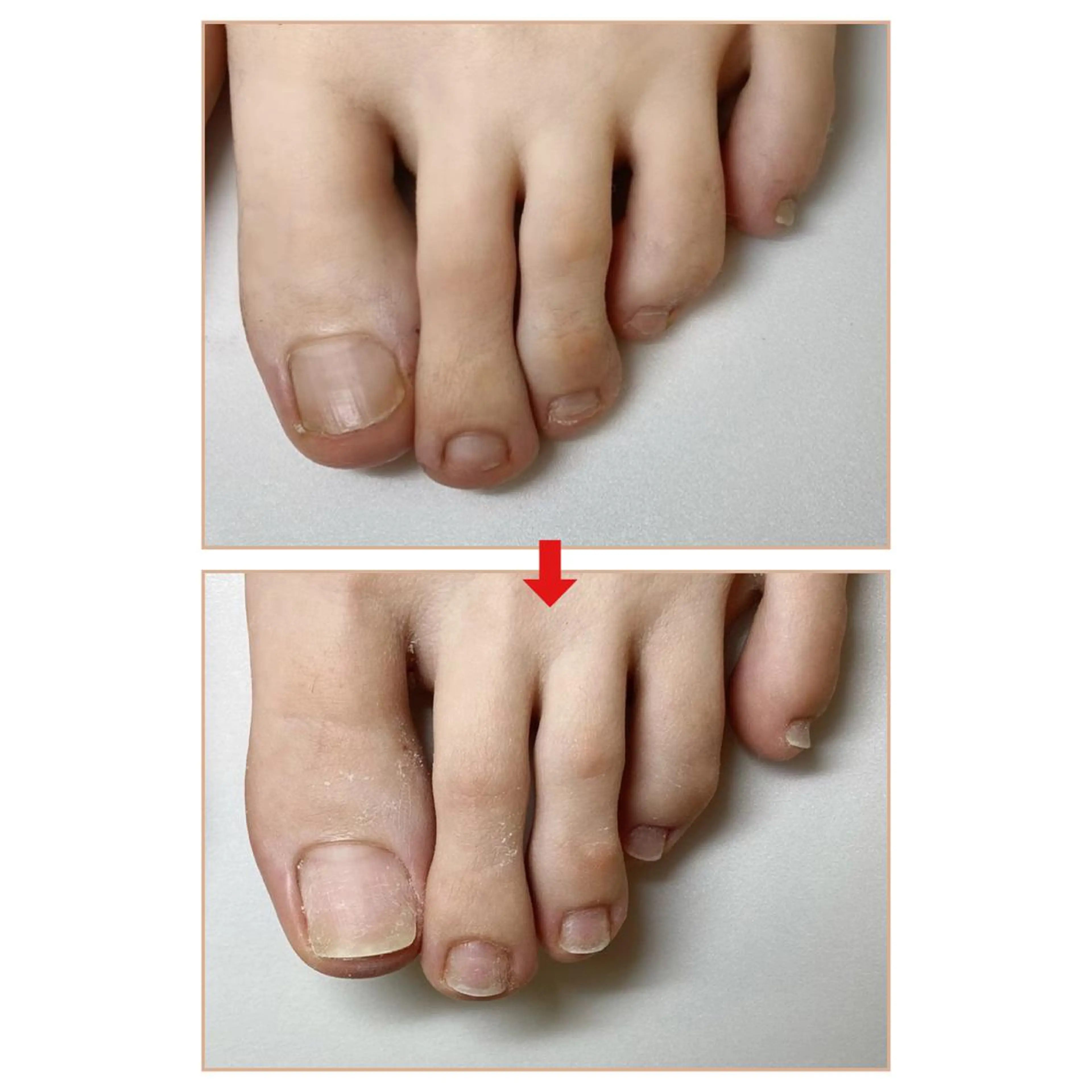 ネイル ネイルサロン アリュームのネイルデザイン