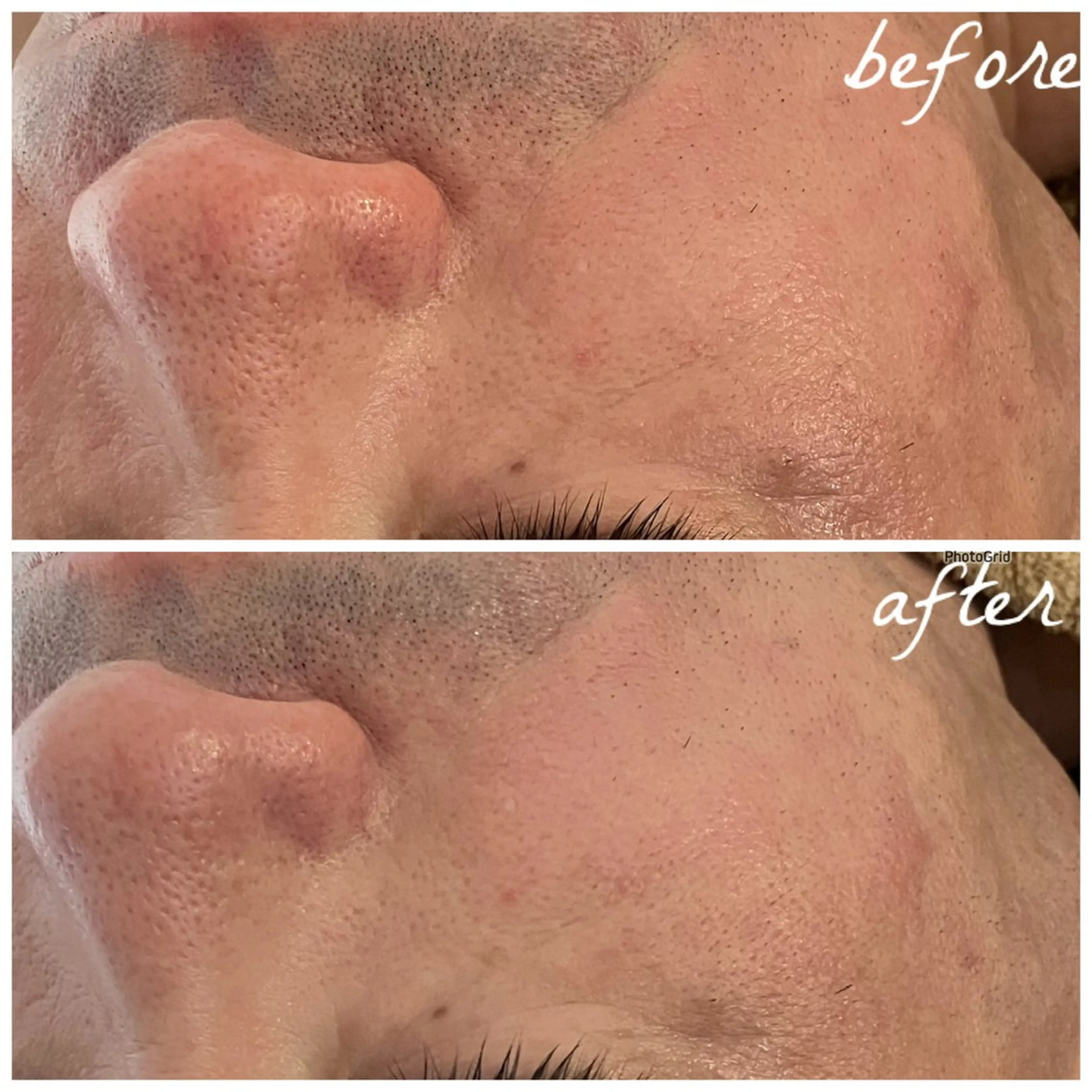 メンズ エステ メナード岐阜茜部 杉浦のエステ・リラクイメージ