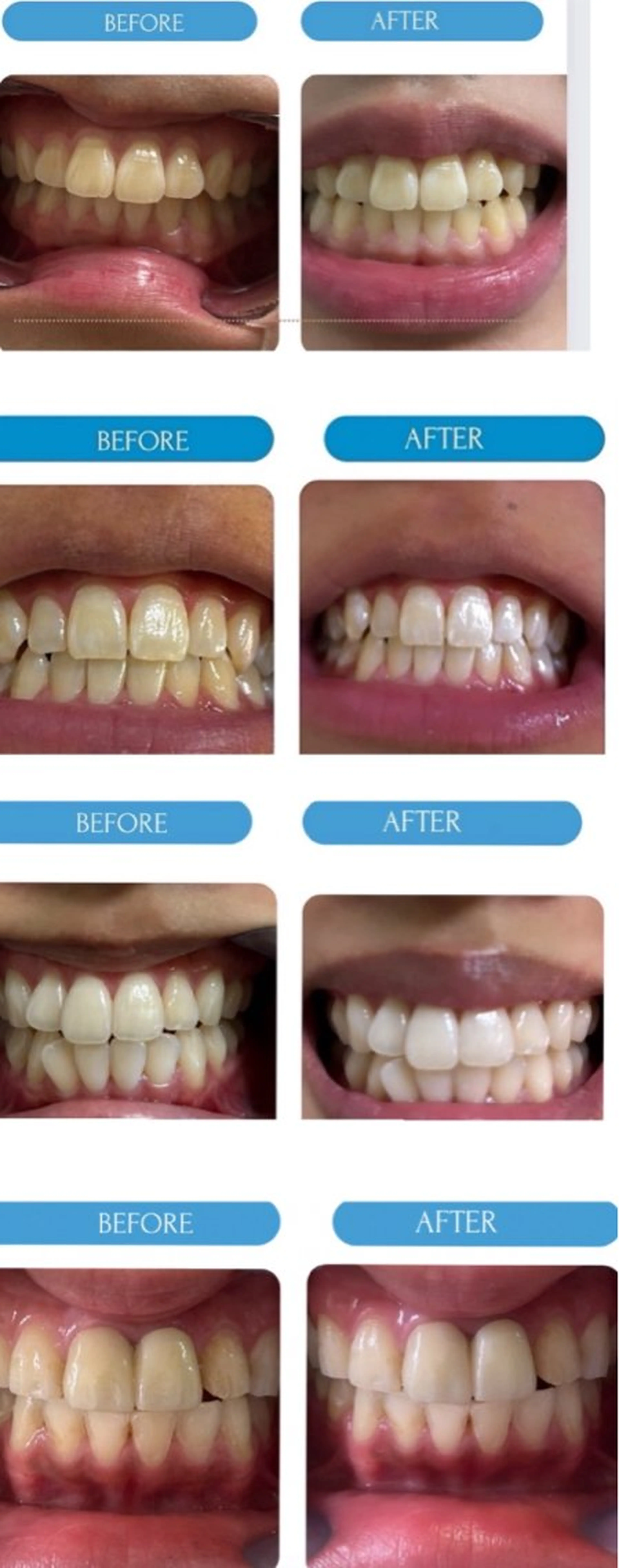 韓国式ホワイトニング R24大阪梅田店のその他イメージ