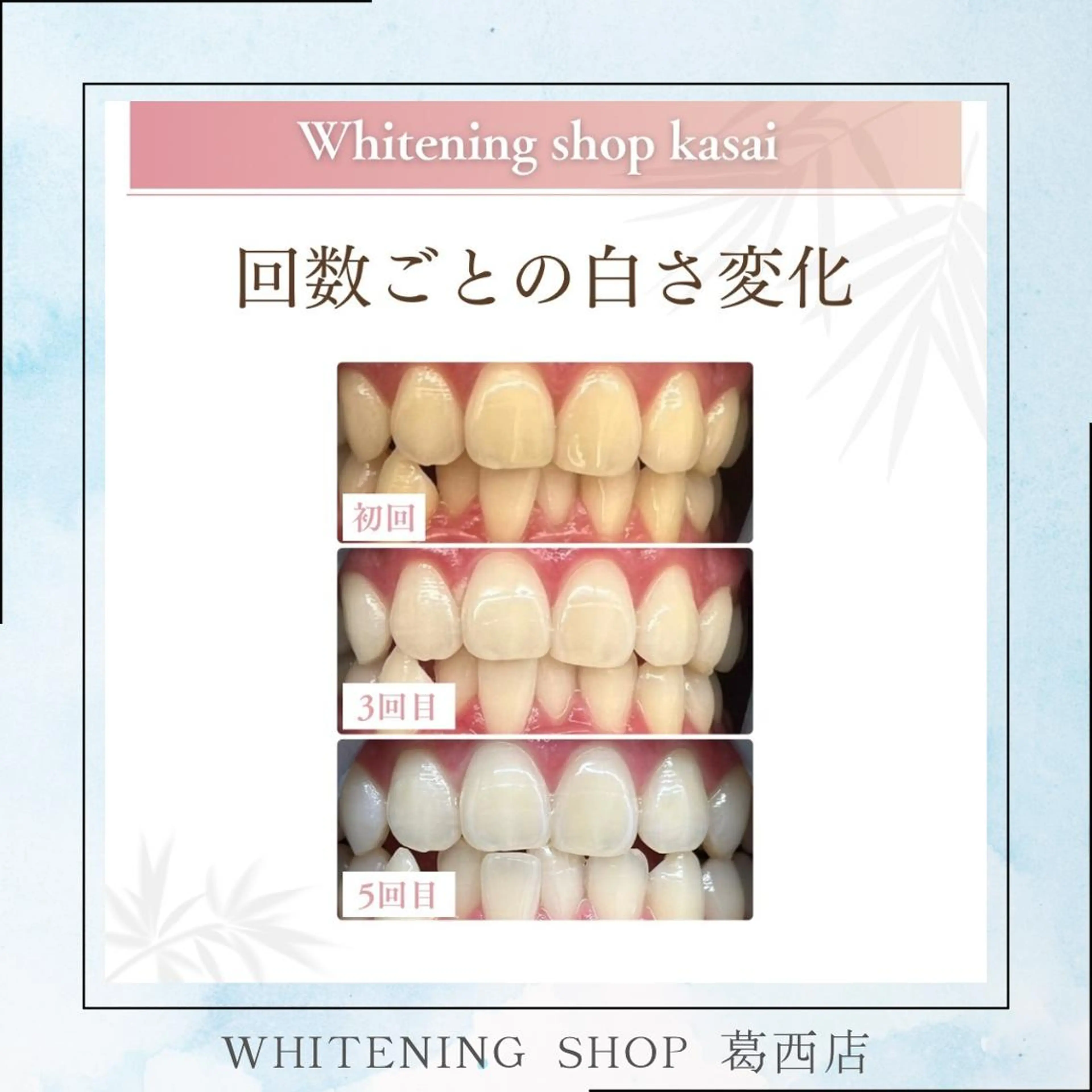 メンズ その他 ホワイトニング ショップ葛西店のその他イメージ