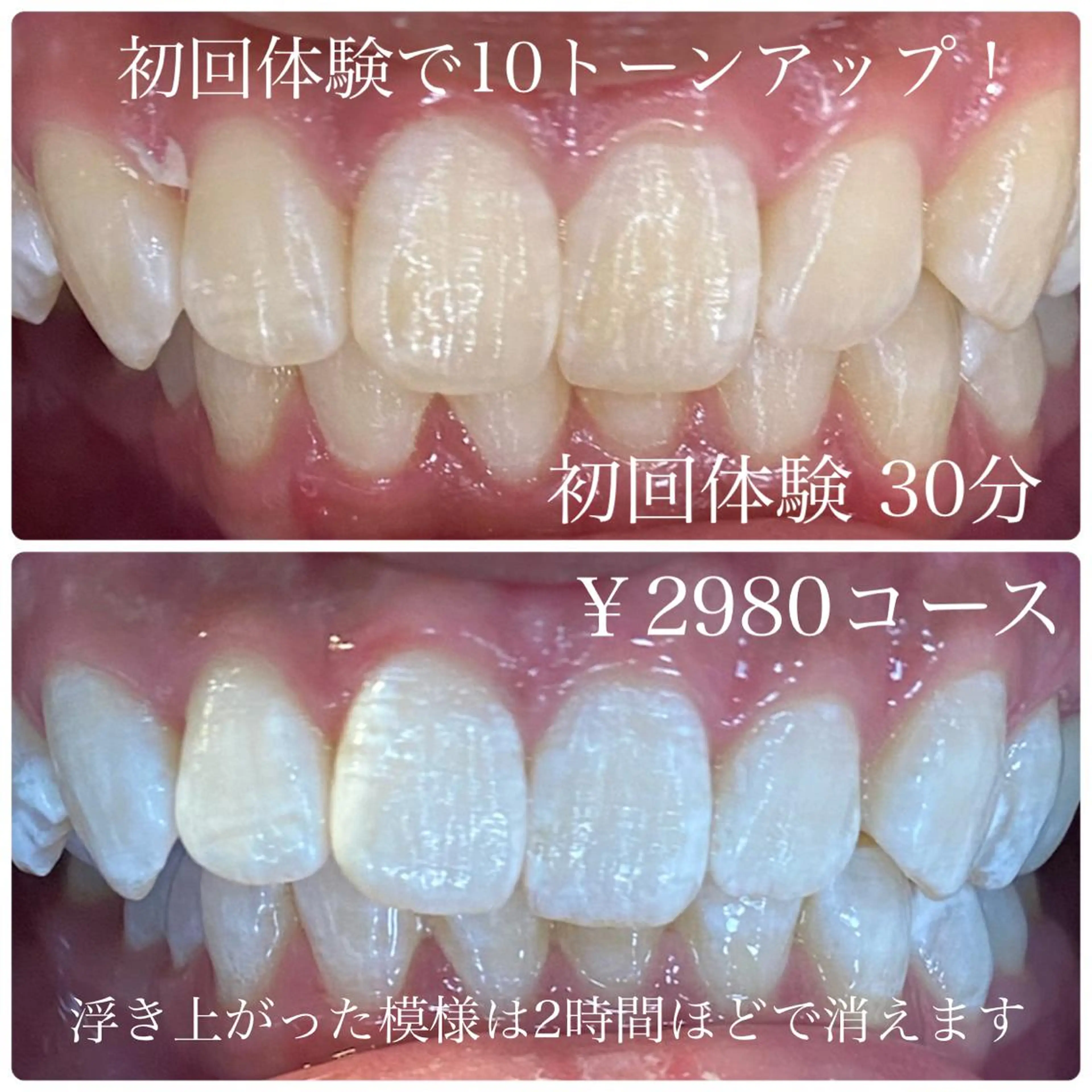 ホワイトニングルーム 川崎店所属・ホワイトニング ルーム 川崎店のその他イメージ