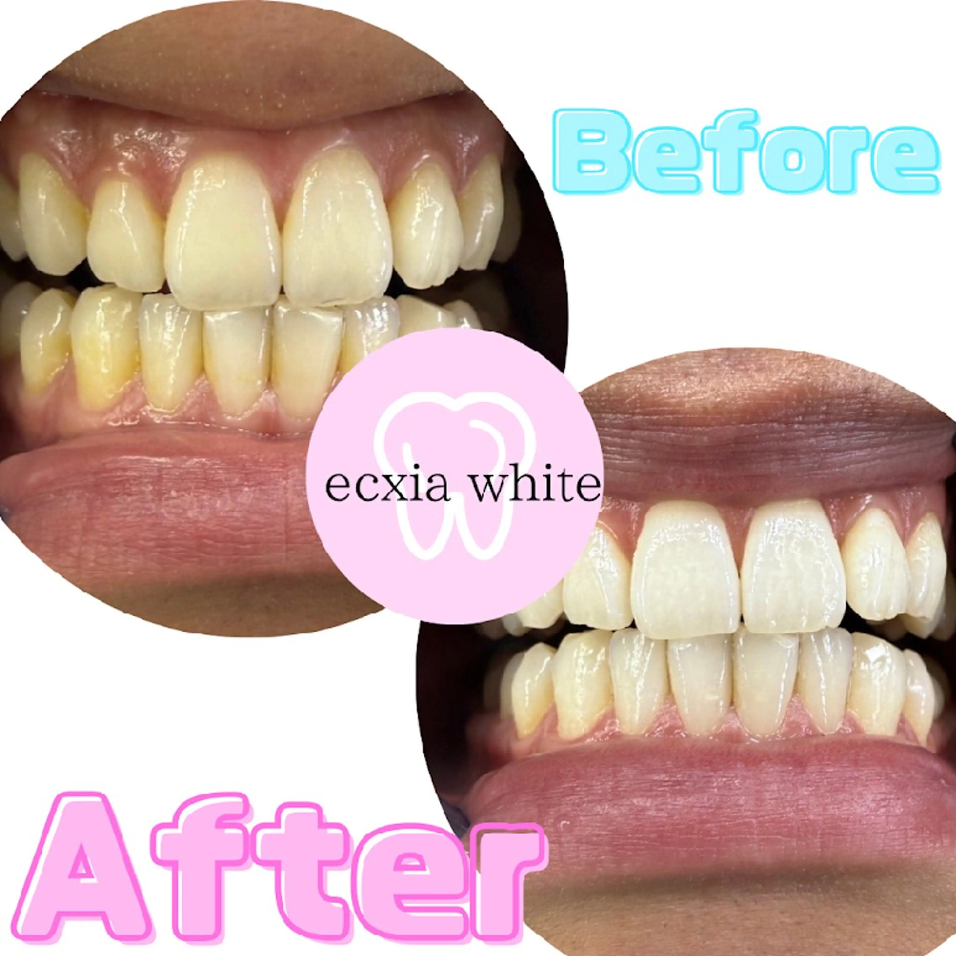 メンズ その他 nanami -ホワイトニングのその他イメージ