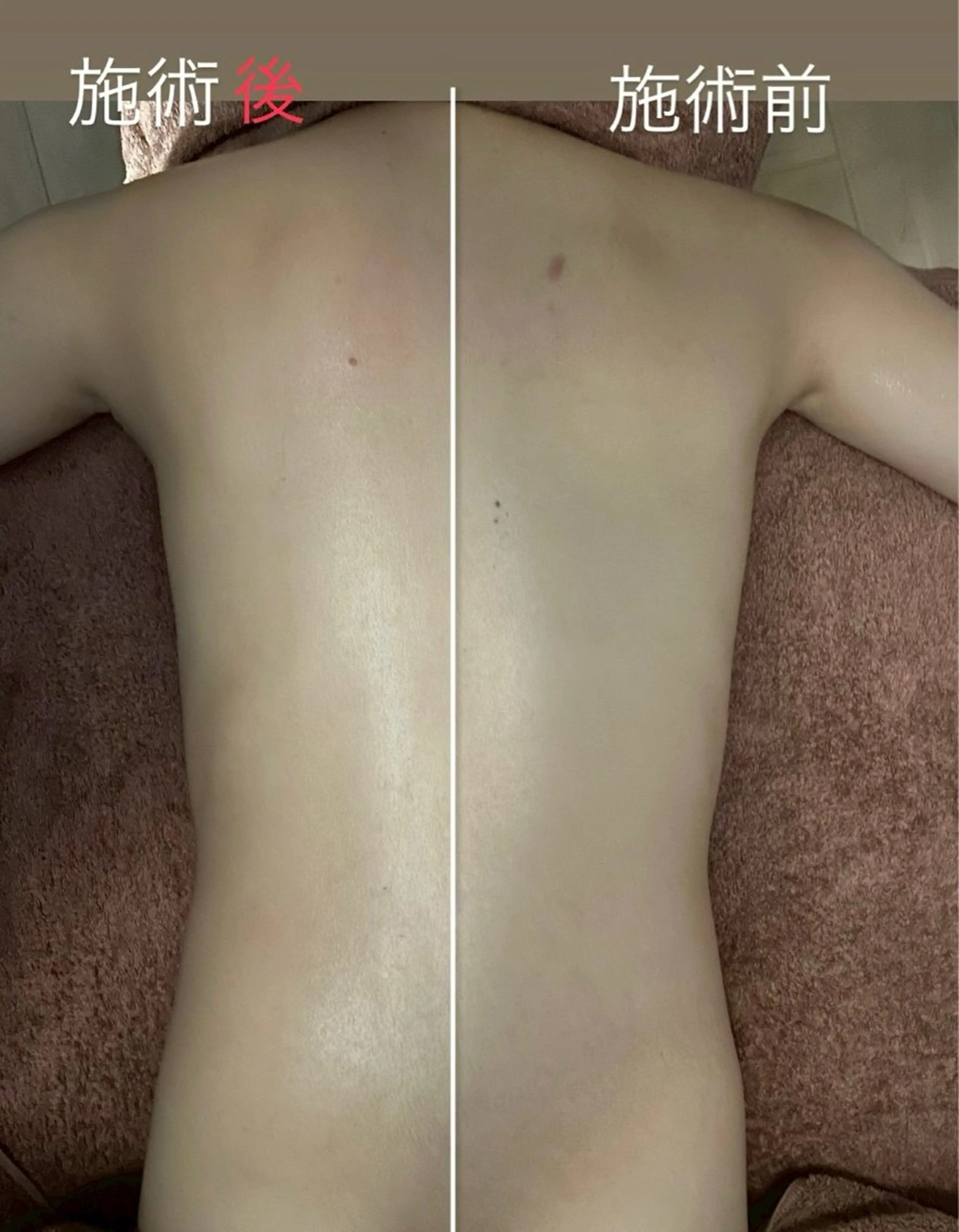 リラク beauty  salon sorelle所属・産毛角質ケア/艶肌 フェイシャルワックスのエステ・リラクイメージ