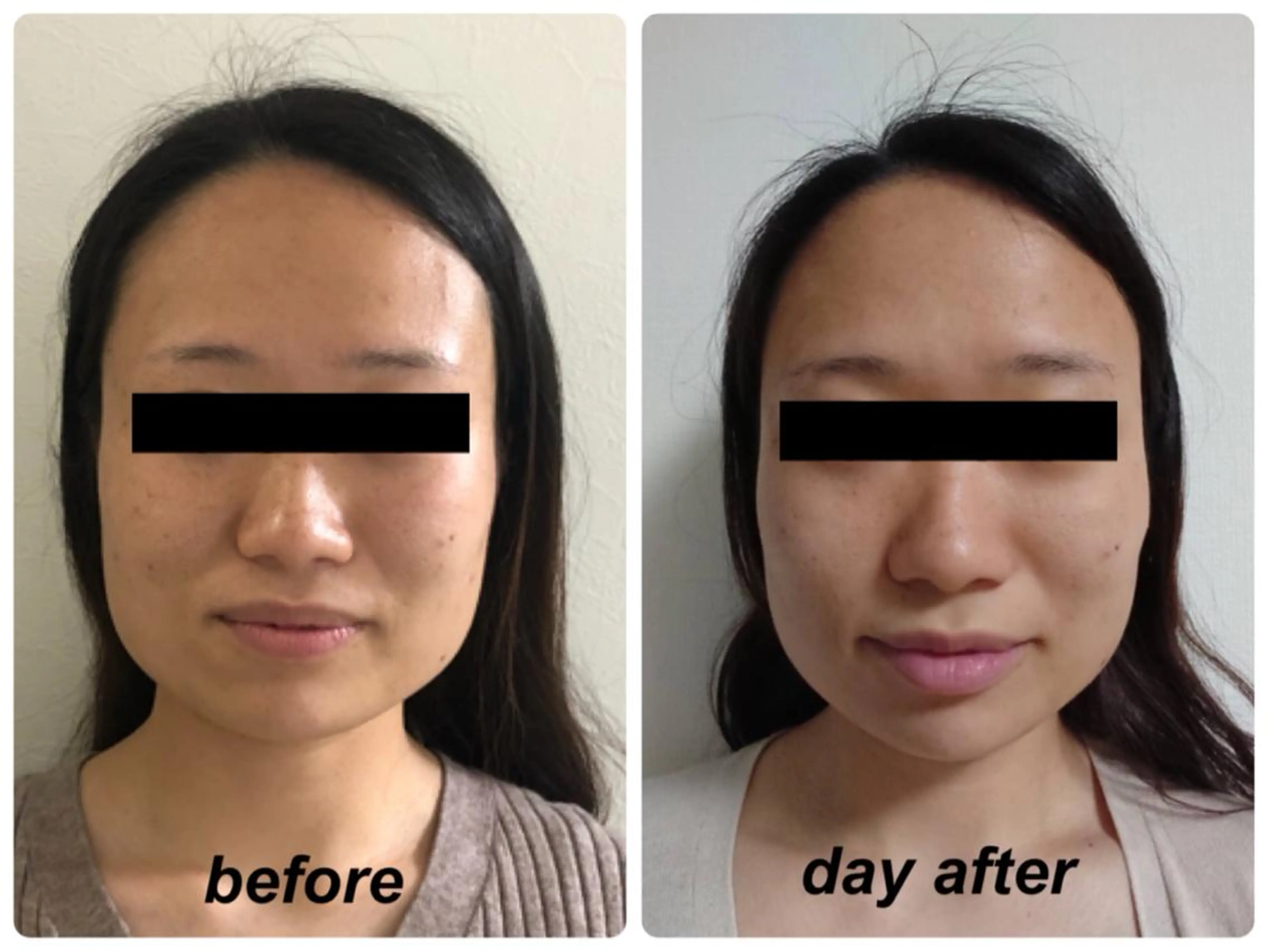 Radiance H.Oのエステ・リラクイメージ