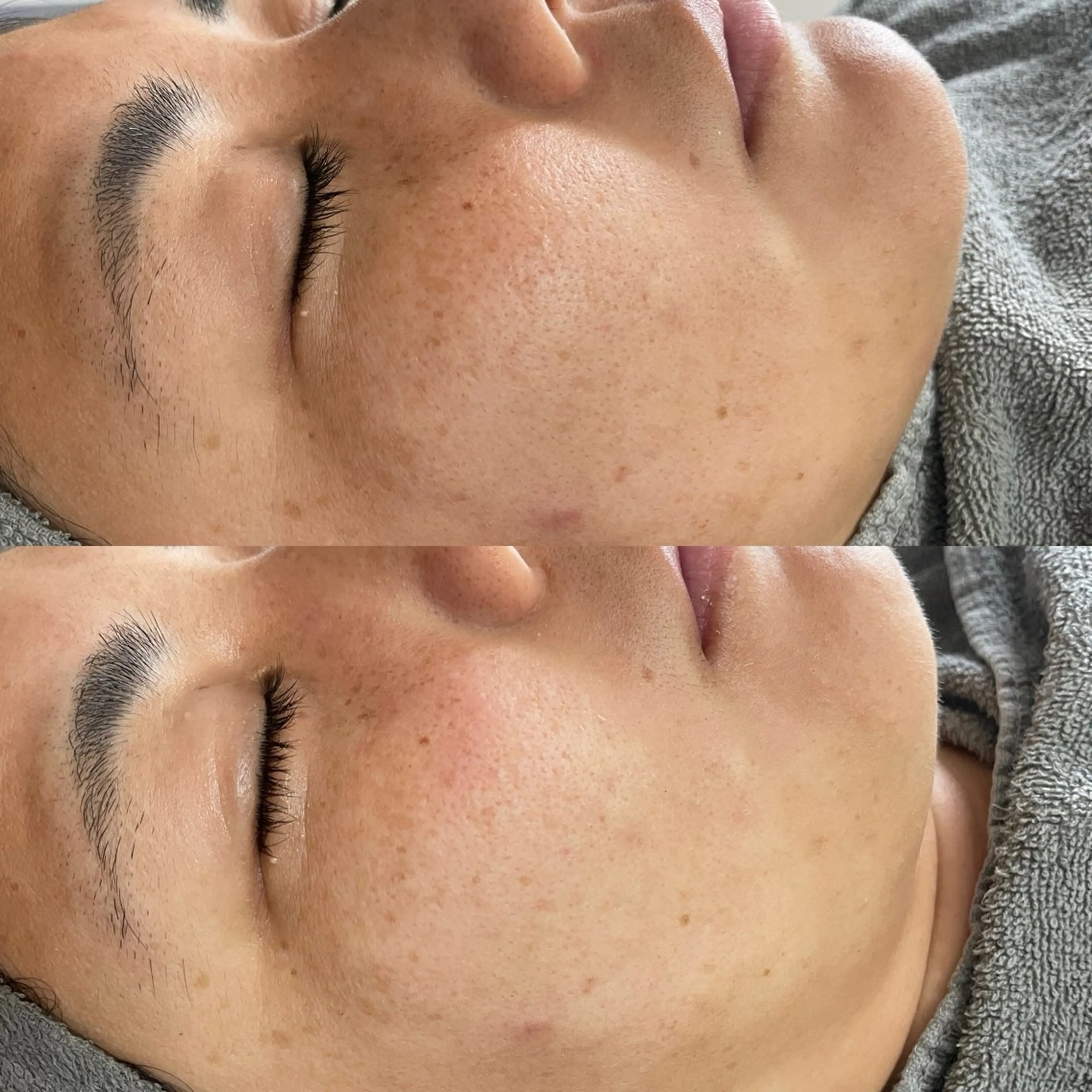 Its Yoshikaのエステ・リラクイメージ