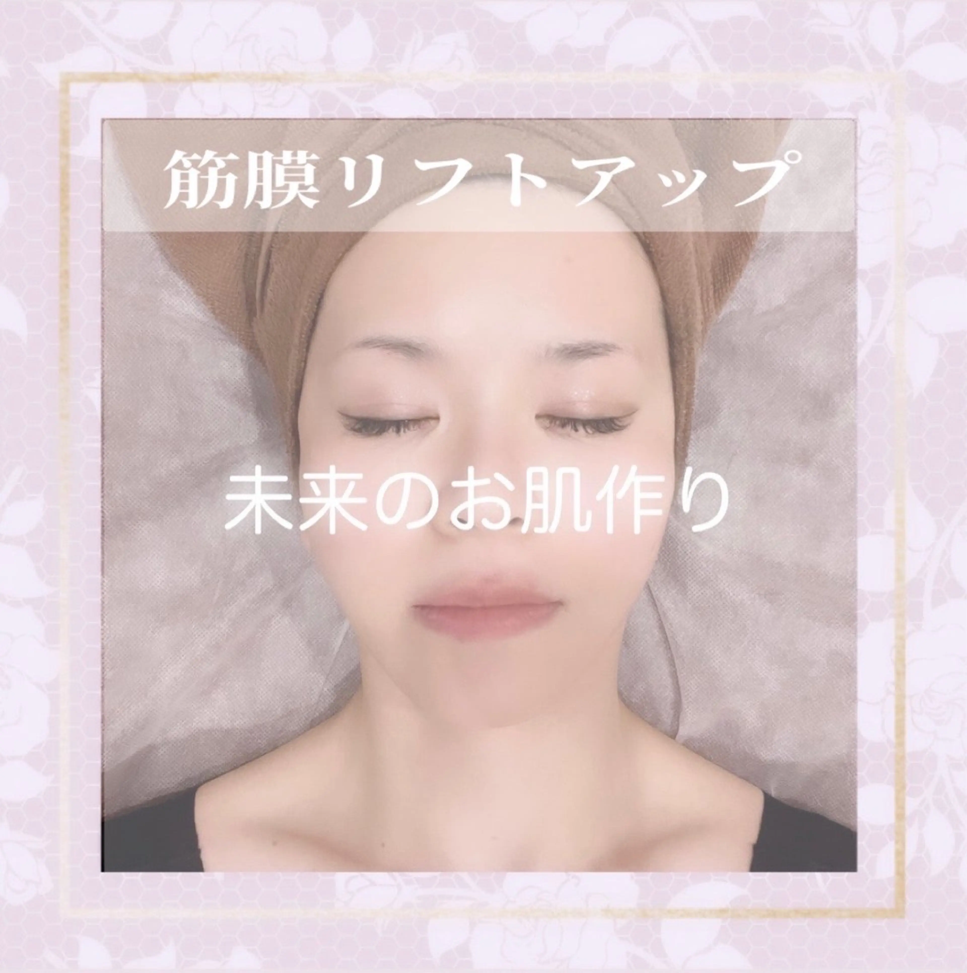 【筋膜フォト】40代以降に超オススメ★ 光ケアでキュッとリフトアップ♪奥まで届く温熱効果でくすみも吹き飛ばし!¥4980の写真