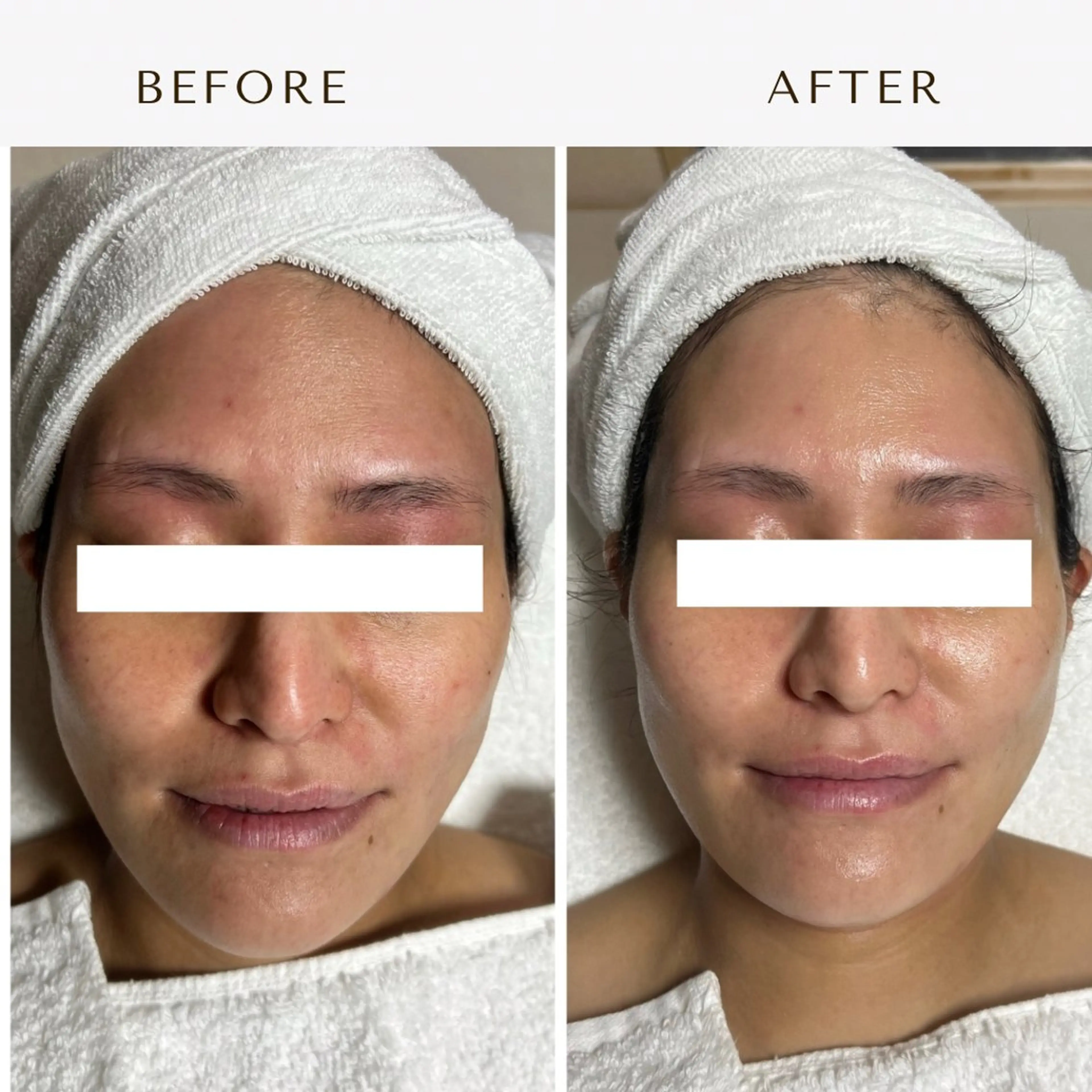 エステ ROR Akariのエステ・リラクイメージ