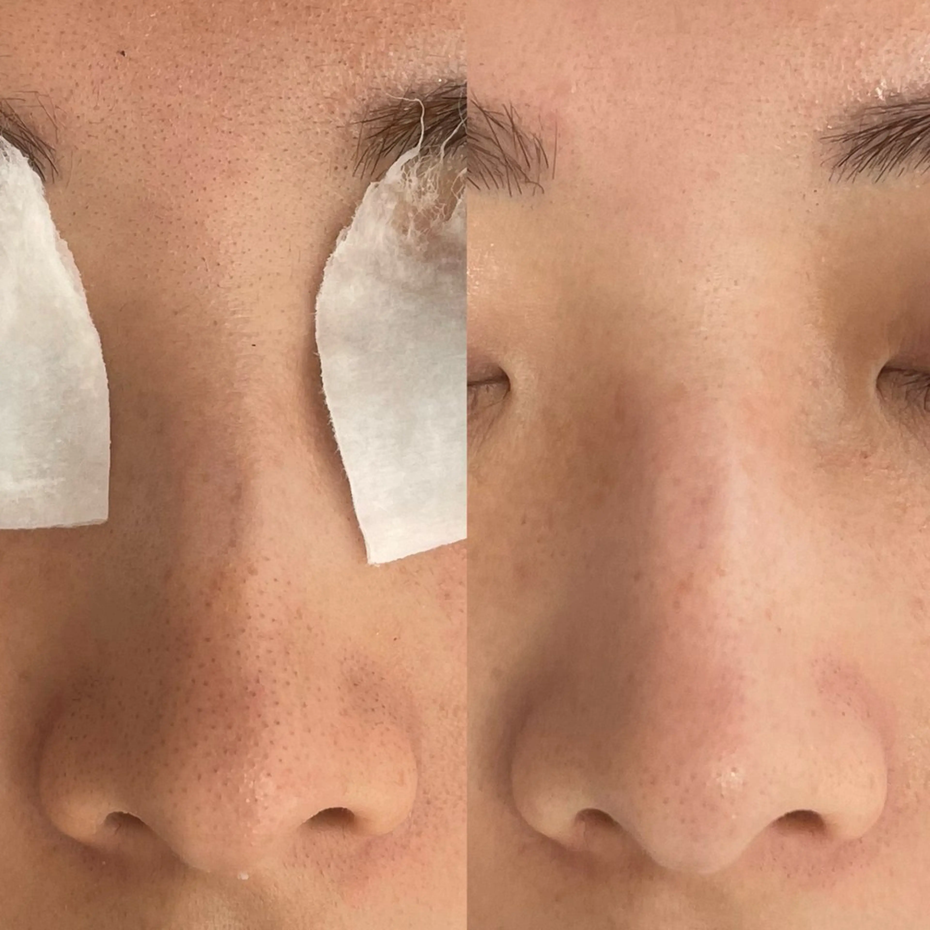 エステ Lien ~beauty salon~所属・福島⌇毛穴専門サロン ⌇﻿モニター募集のエステ・リラクイメージ