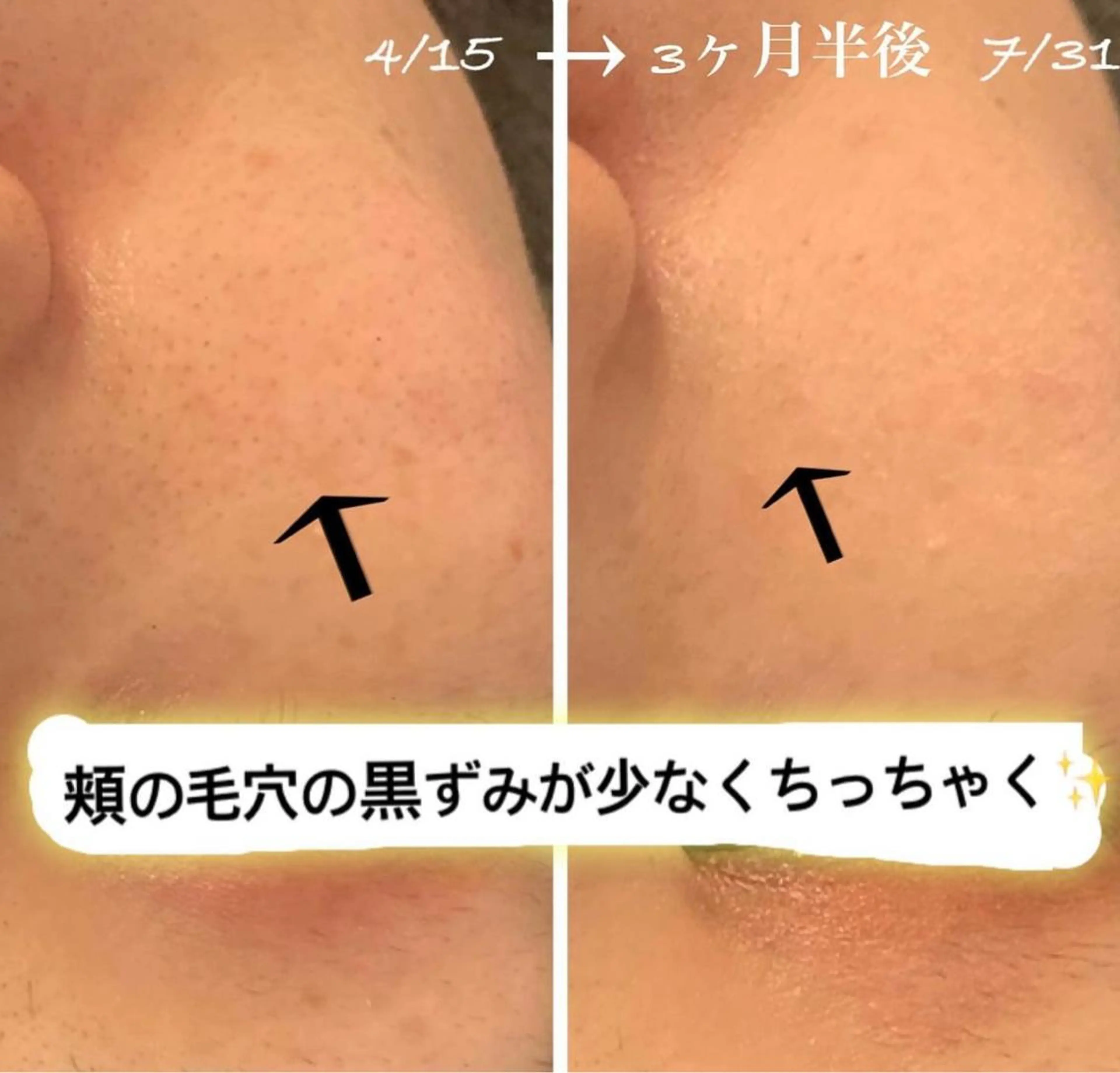 エステ kana ハーブピーリング🌿のエステ・リラクイメージ