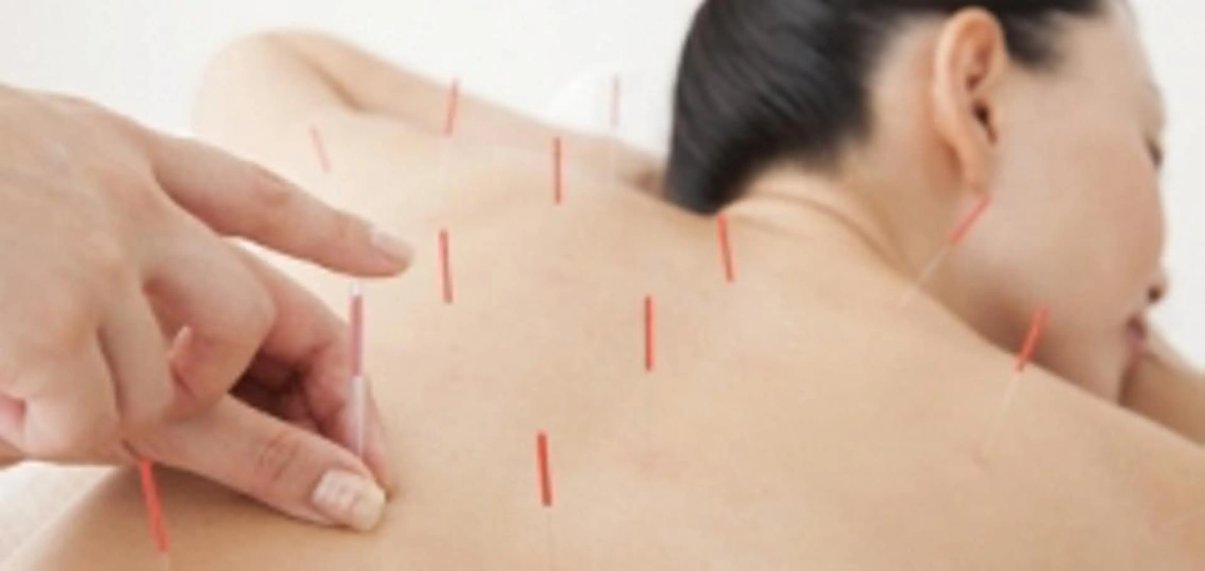 美容整体＋鍼灸(体) ※初回限定の写真