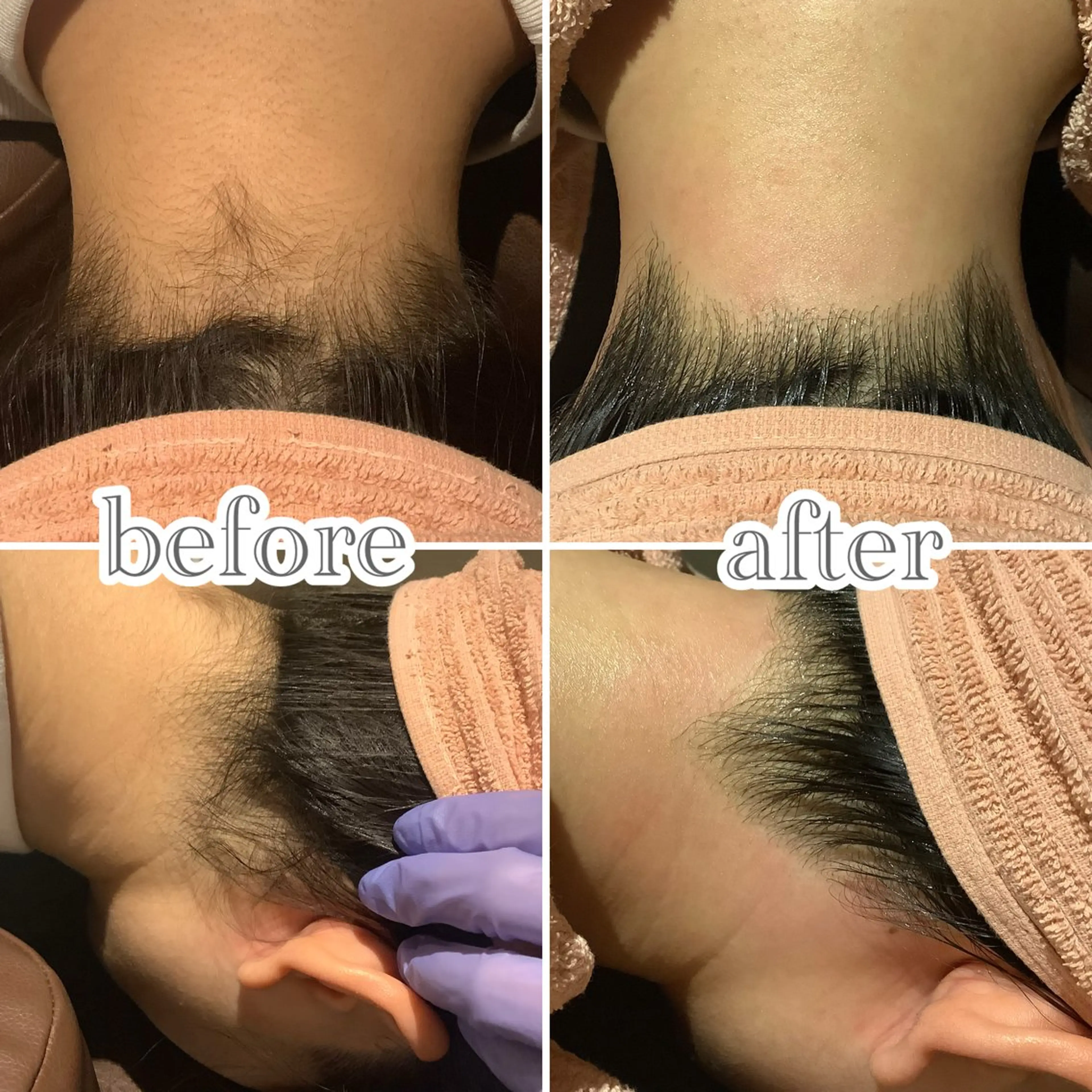 脱毛 脱毛&エステサロン JIGGLY武蔵小山のエステ・リラクイメージ