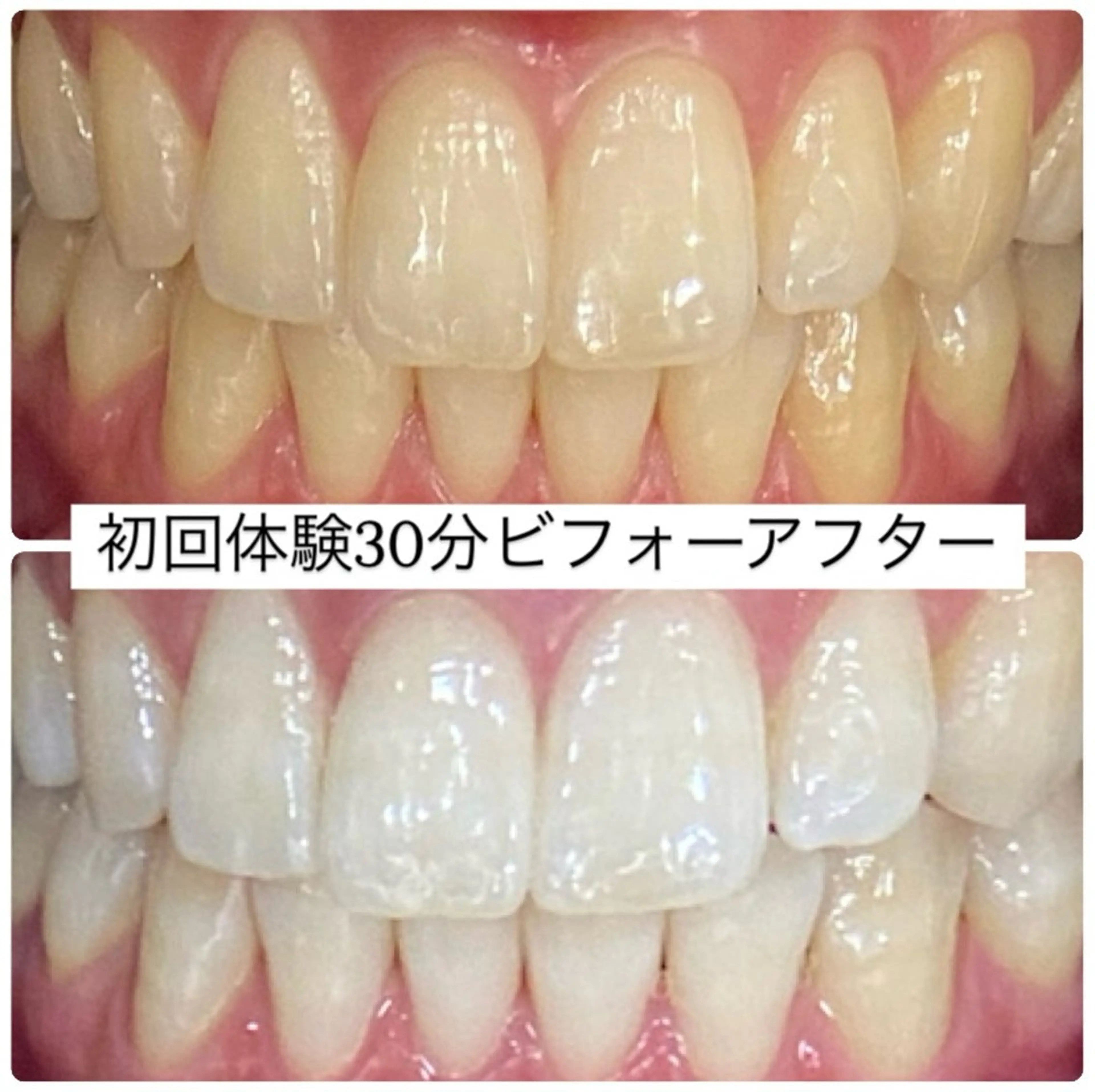 ホワイトニングルーム 横浜店のその他イメージ