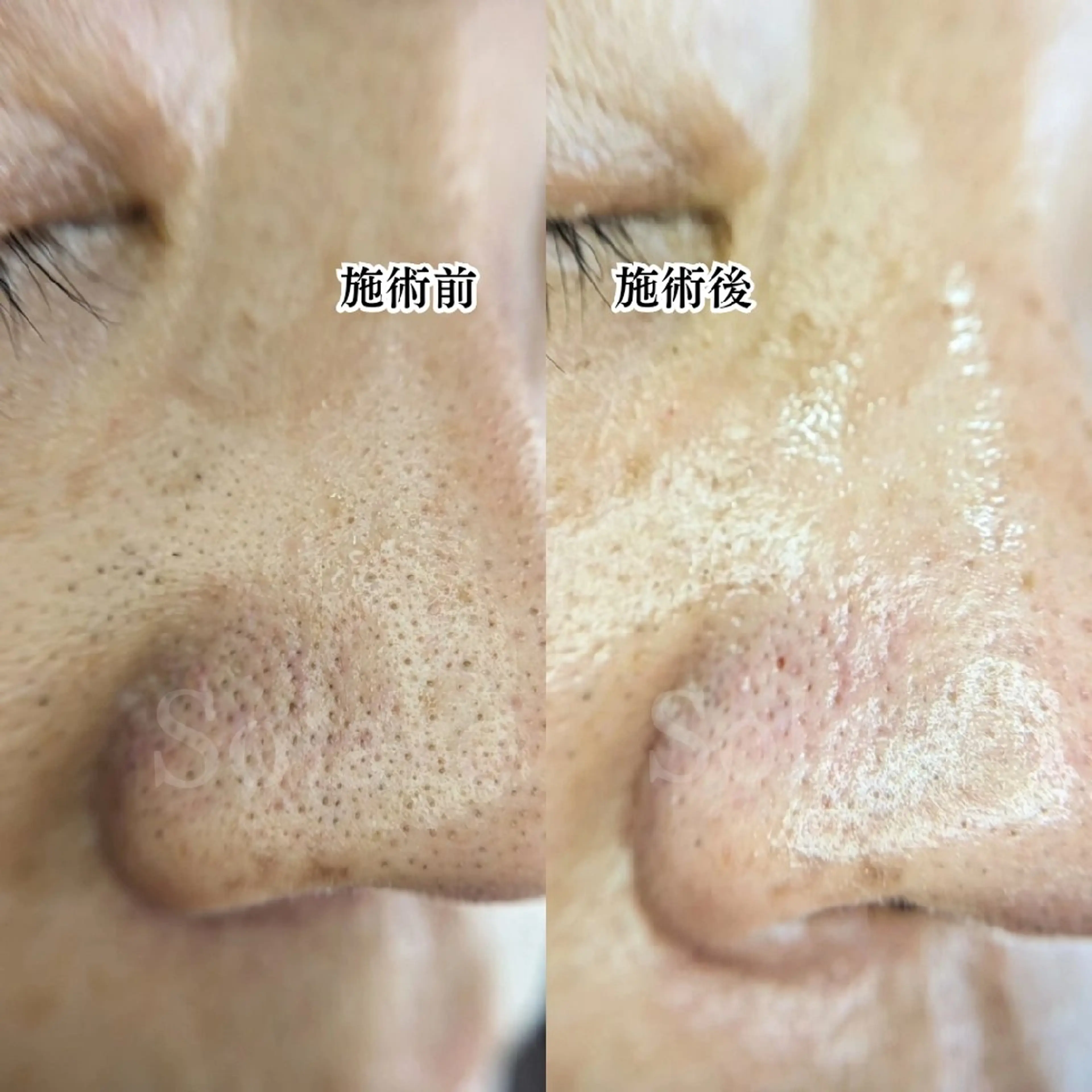  毛穴洗浄・まつ毛 の専門店 ソラーレのエステ・リラクイメージ