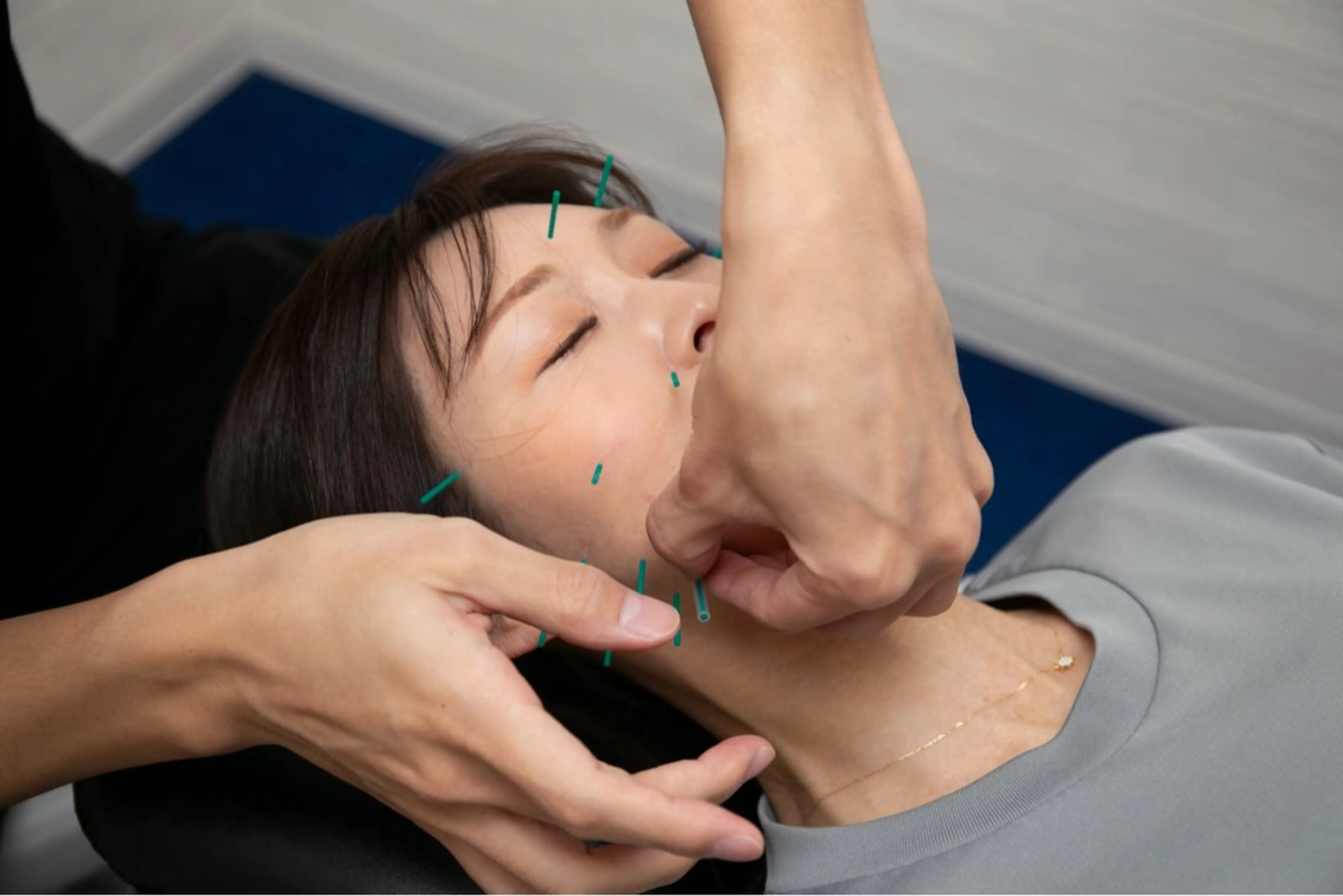 【　恵比寿　美容鍼＋美容整体　モニター募集✨】 ◎クチコミと写真のお願い　-お顔のたるみやほうれい線、不眠の方に-の写真